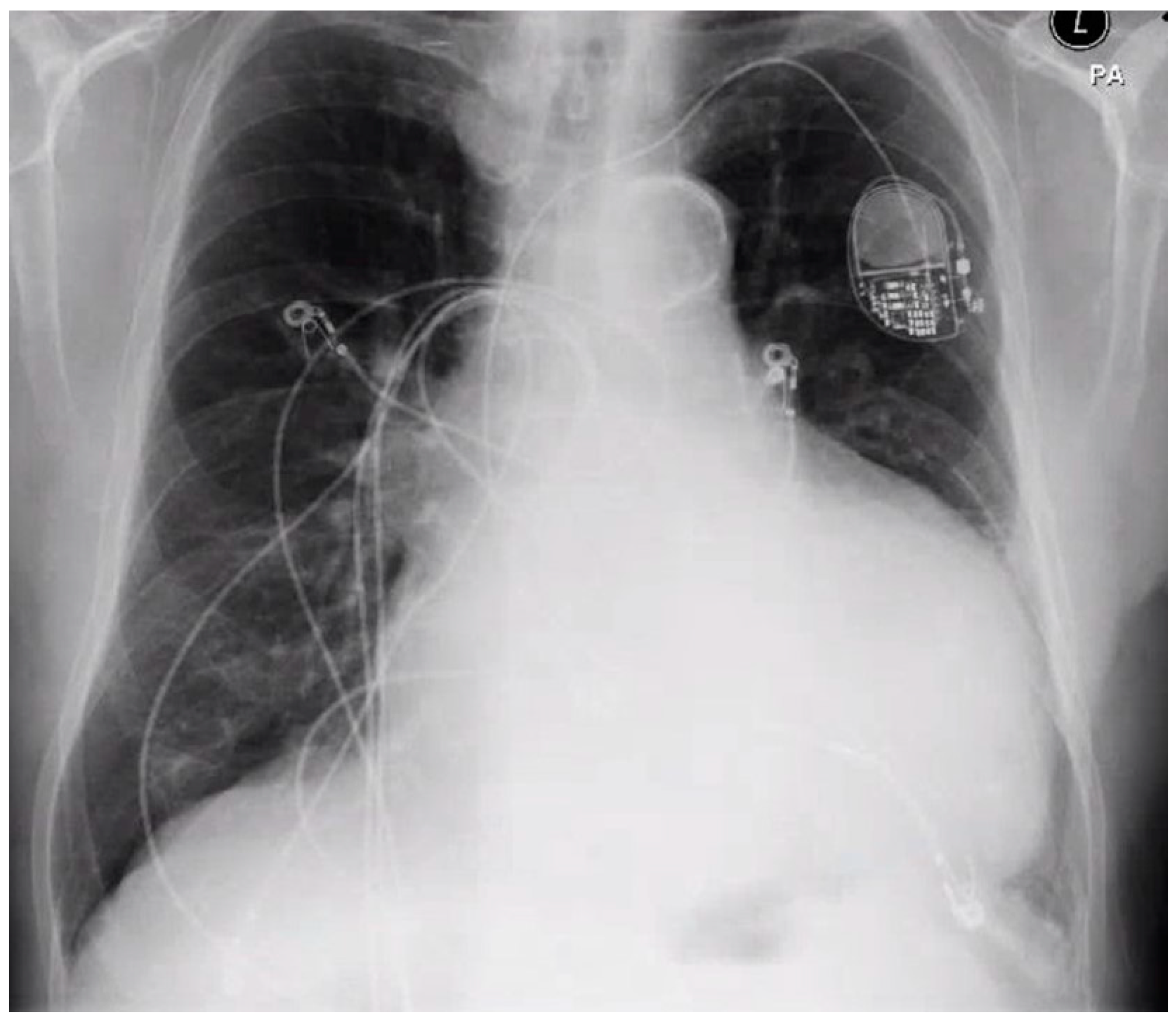 Hearts 03 00010 g001