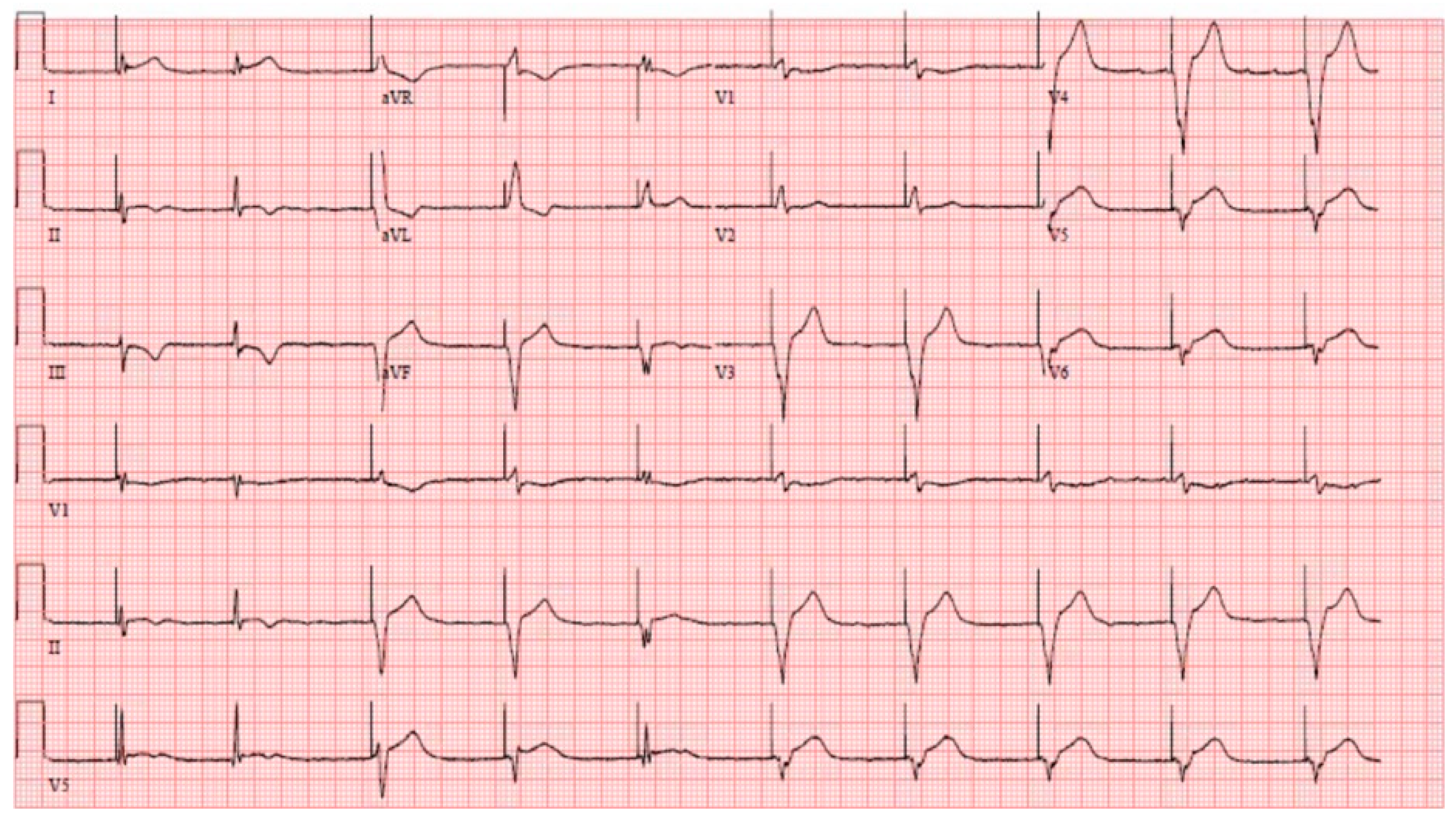 Hearts 03 00010 g002