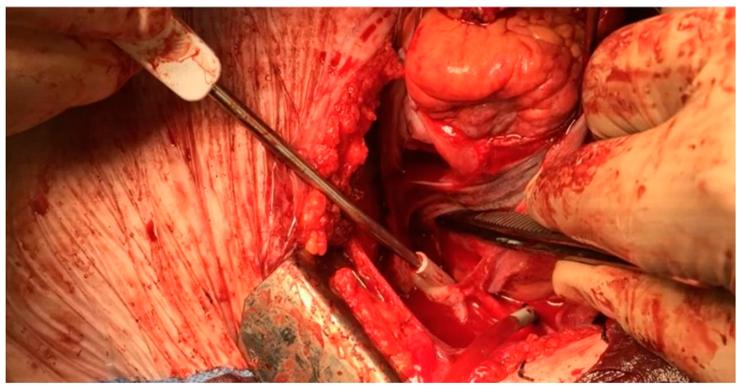 Hearts 03 00010 g003