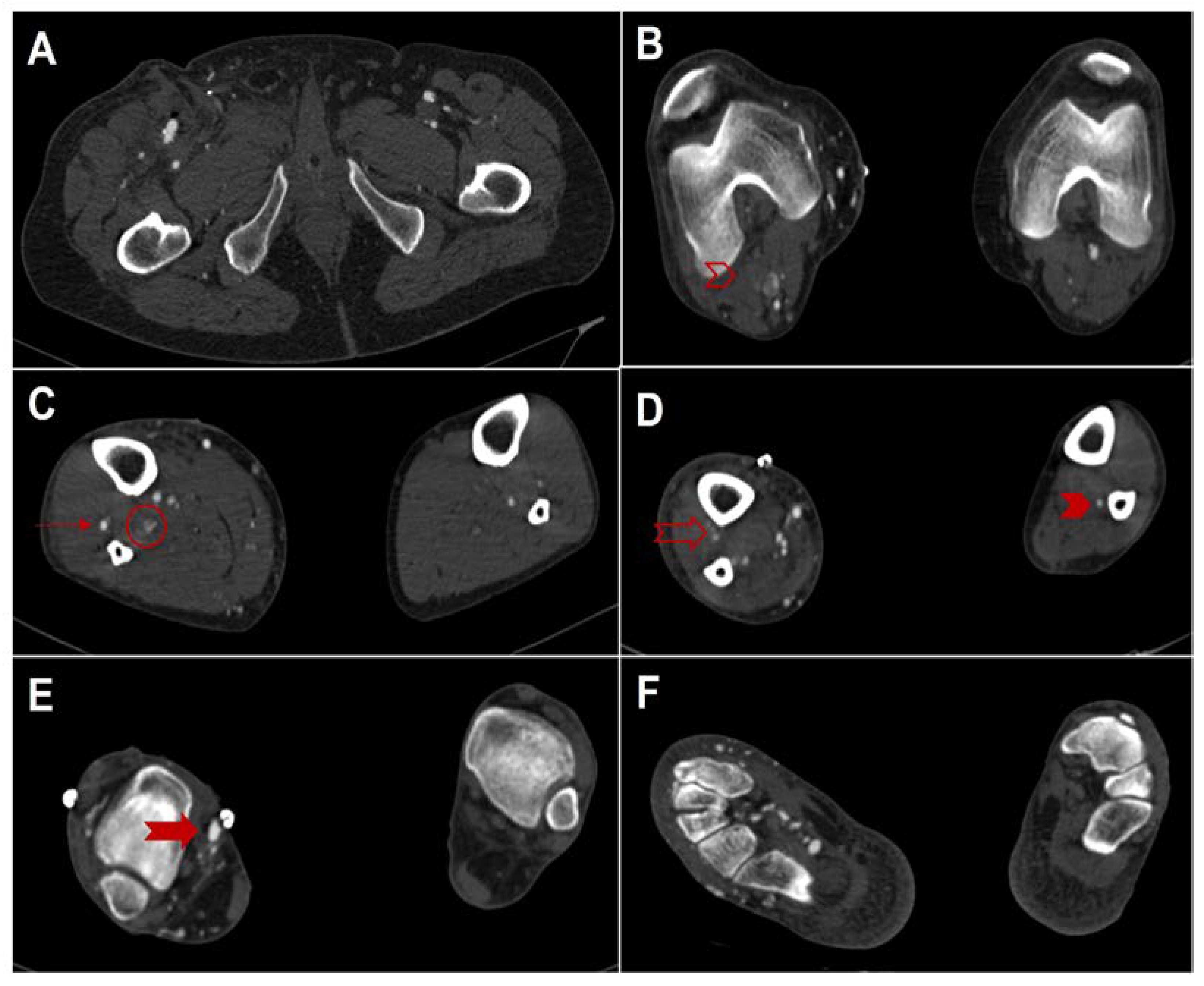 Hearts 04 00002 g002 Hearts 04 00002 g002