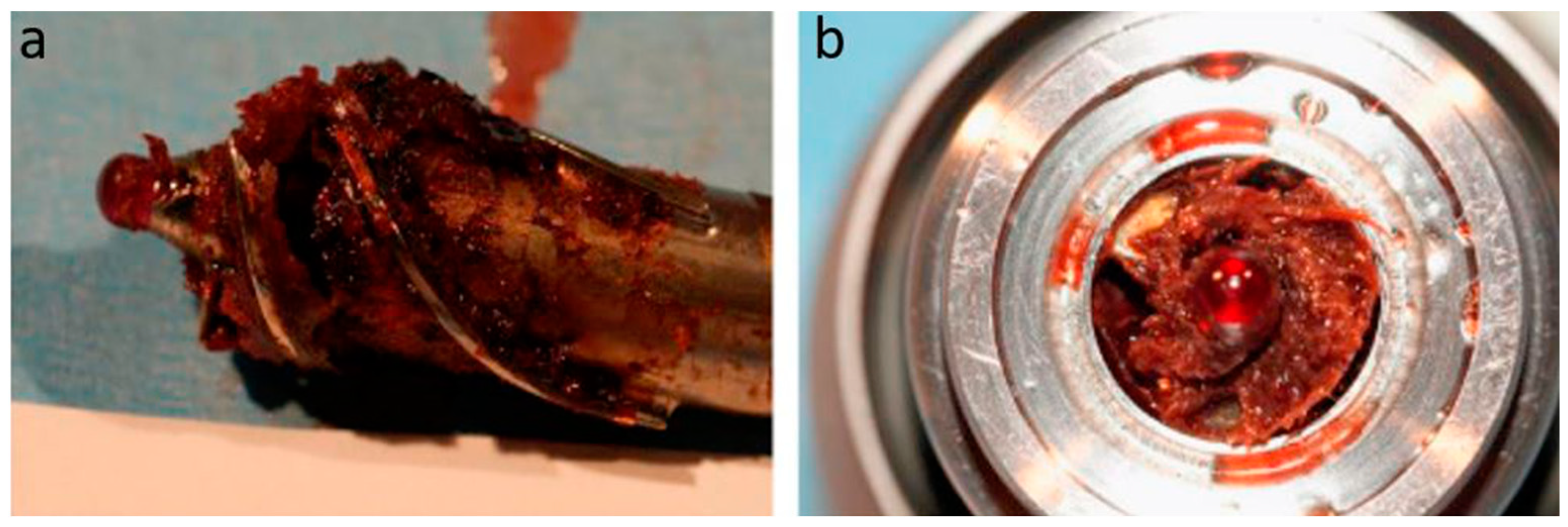 Hearts 05 00008 g002 Hearts 05 00008 g002