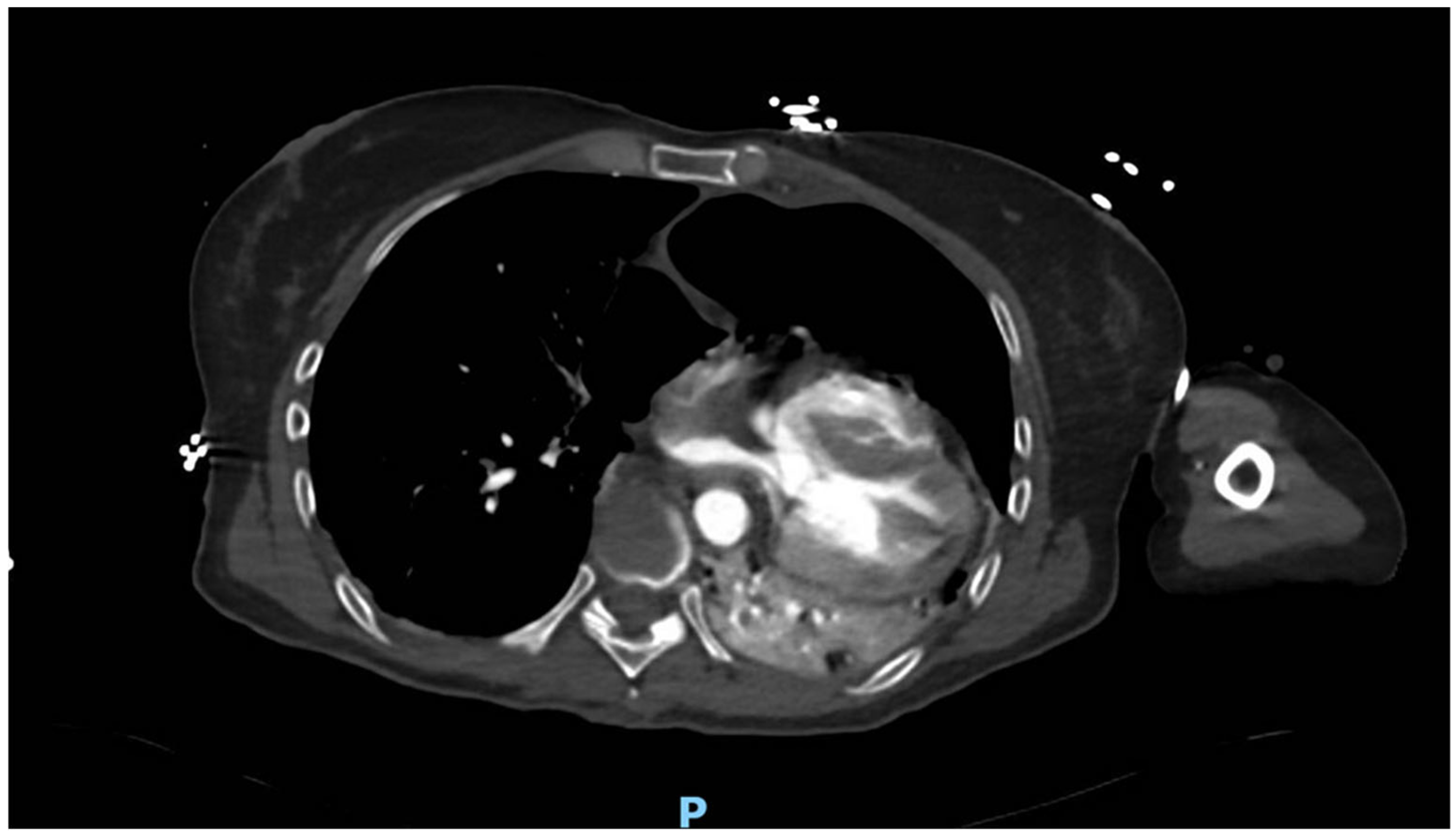 Hearts 05 00021 g001