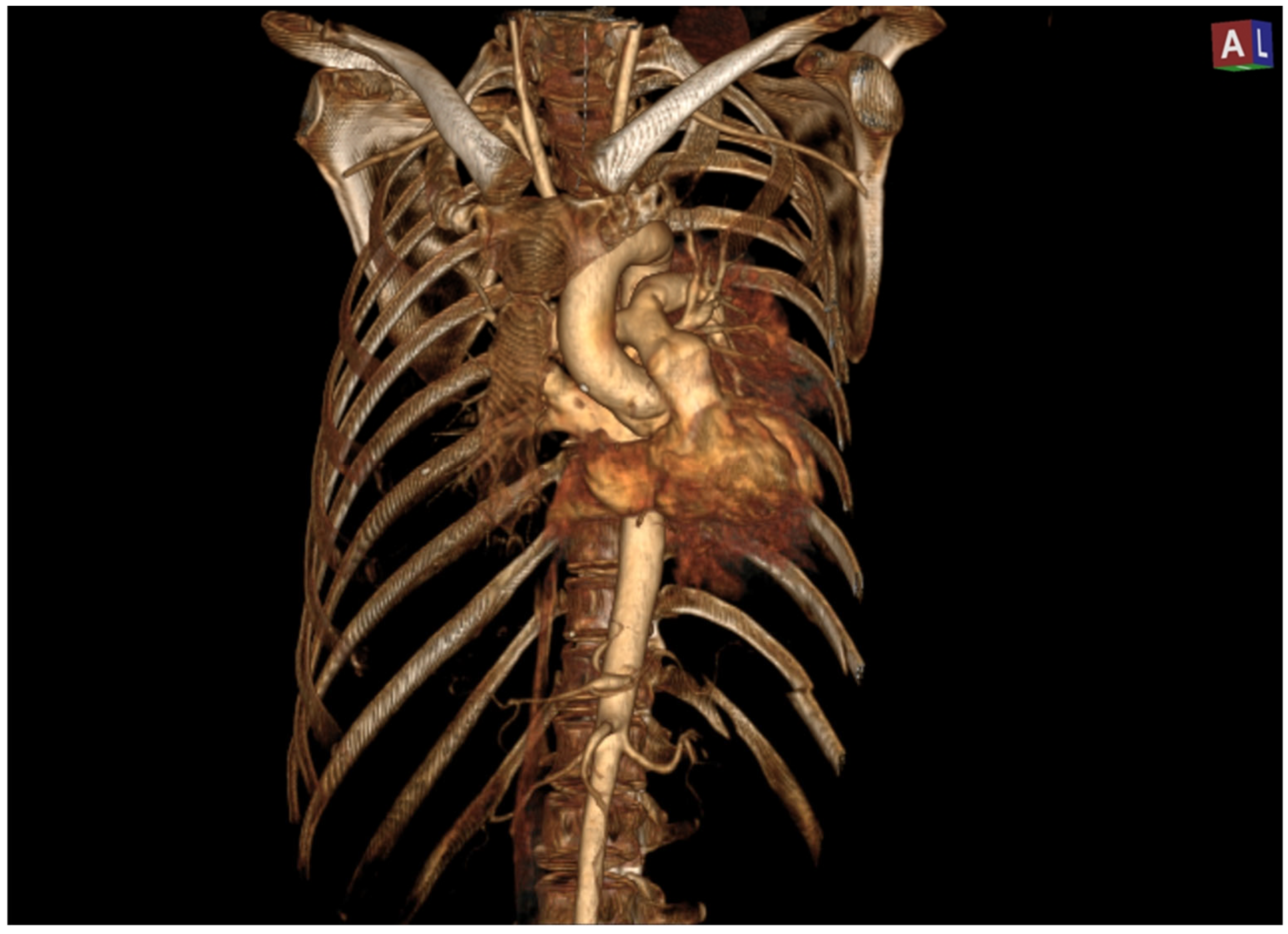 Hearts 05 00021 g002