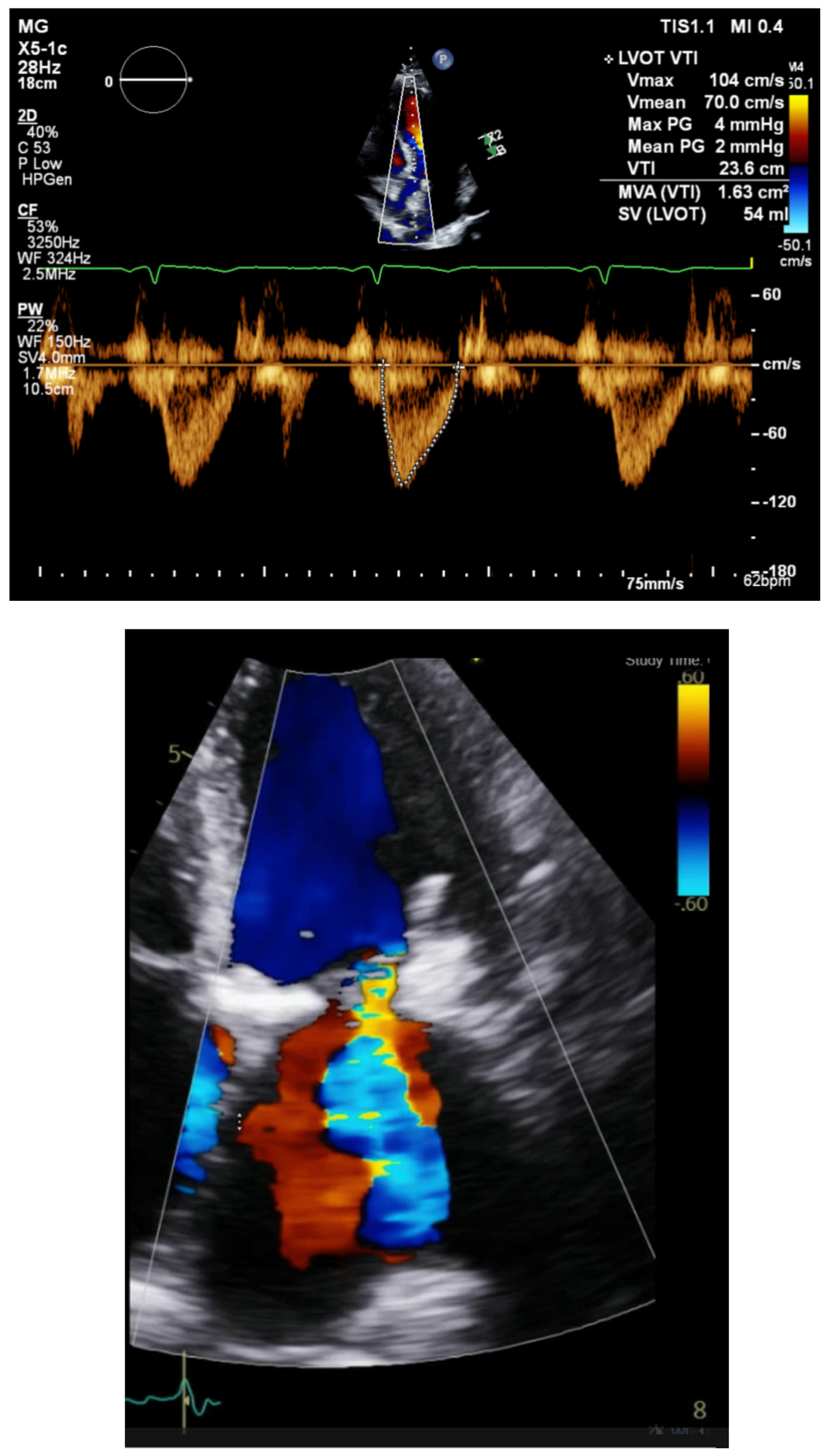 Hearts 05 00032 g004