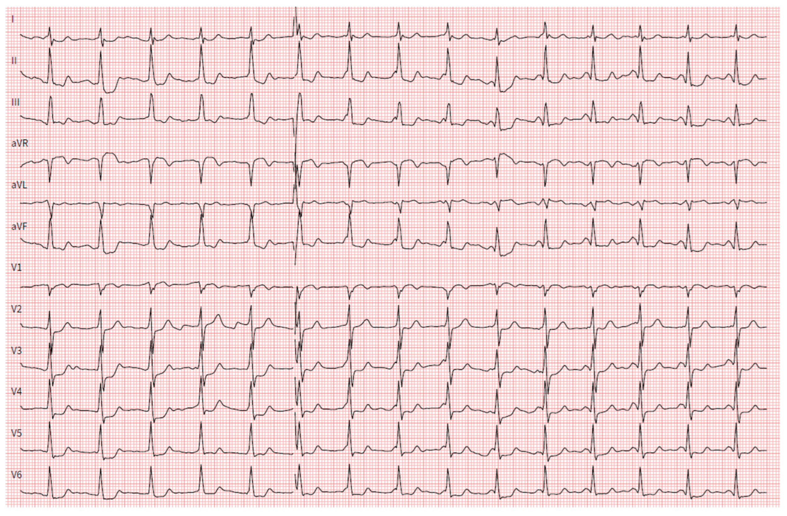 Hearts 05 00034 g003