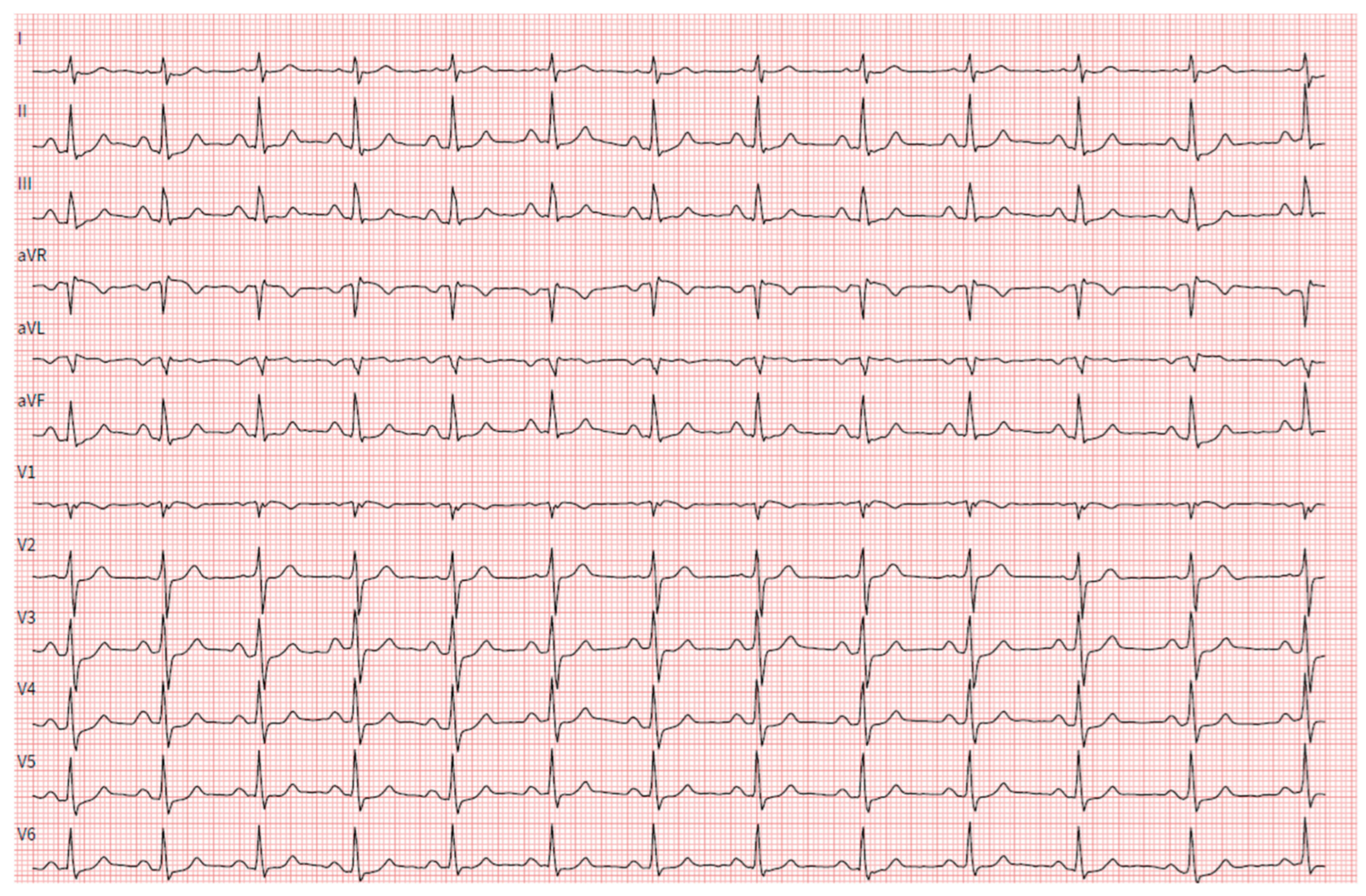 Hearts 05 00034 g004