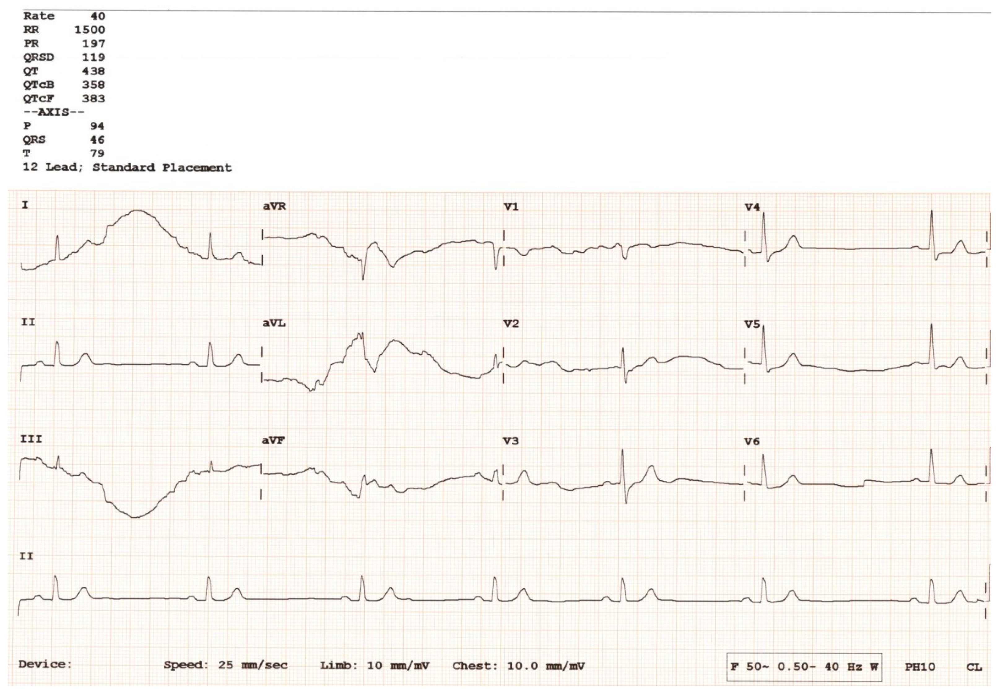 Hearts 05 00034 g005
