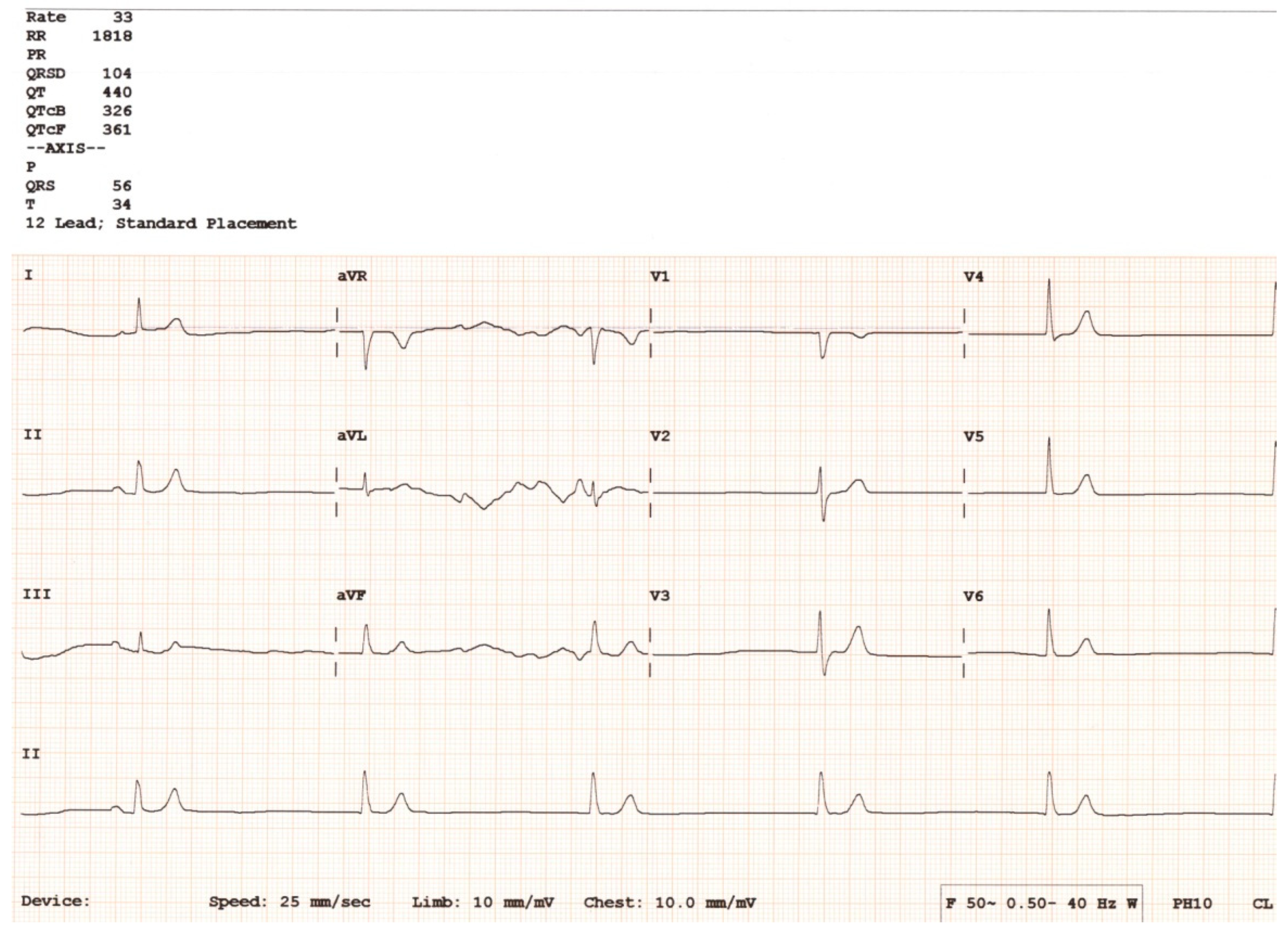 Hearts 05 00034 g006