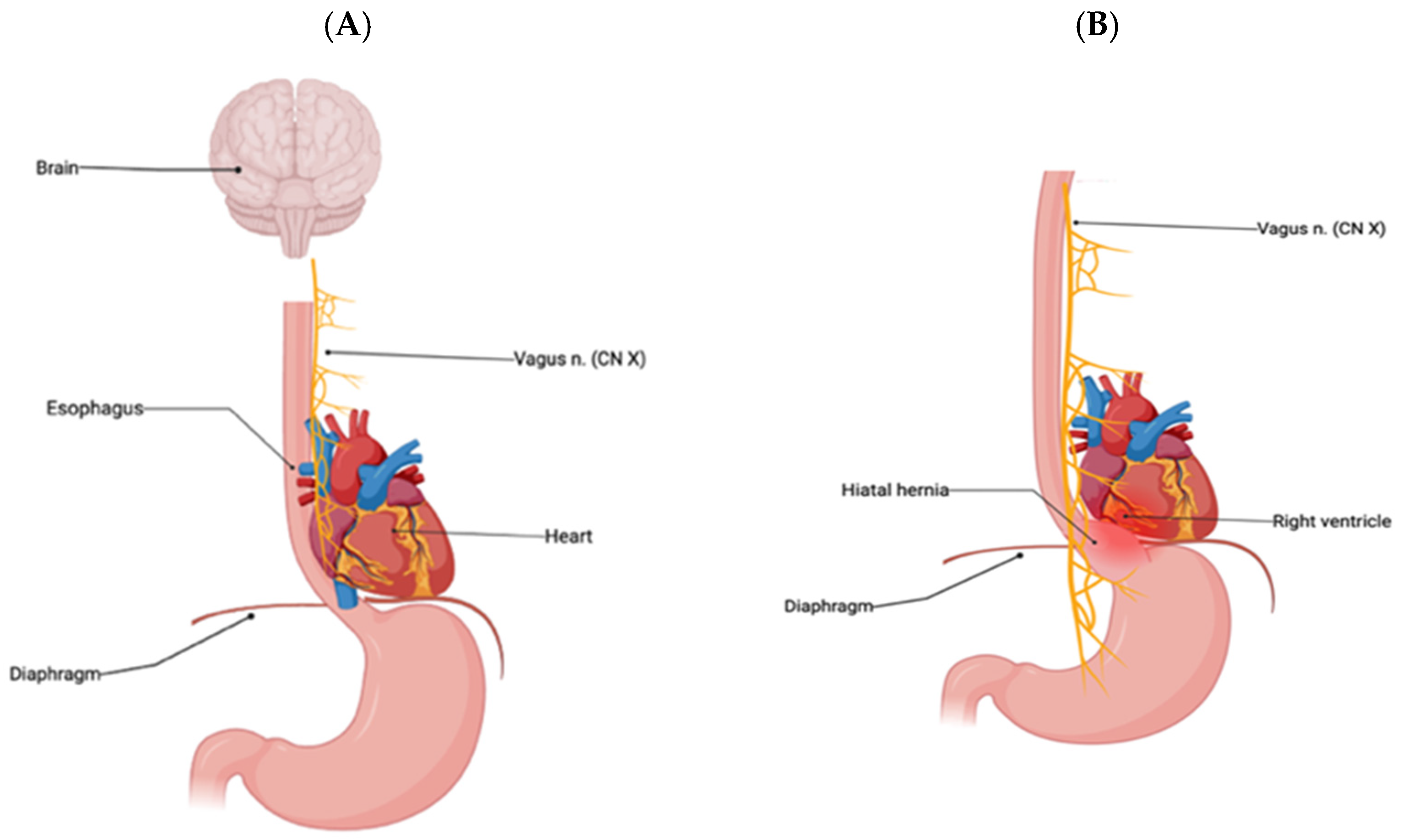 Hearts 05 00038 g004 Hearts 05 00038 g004