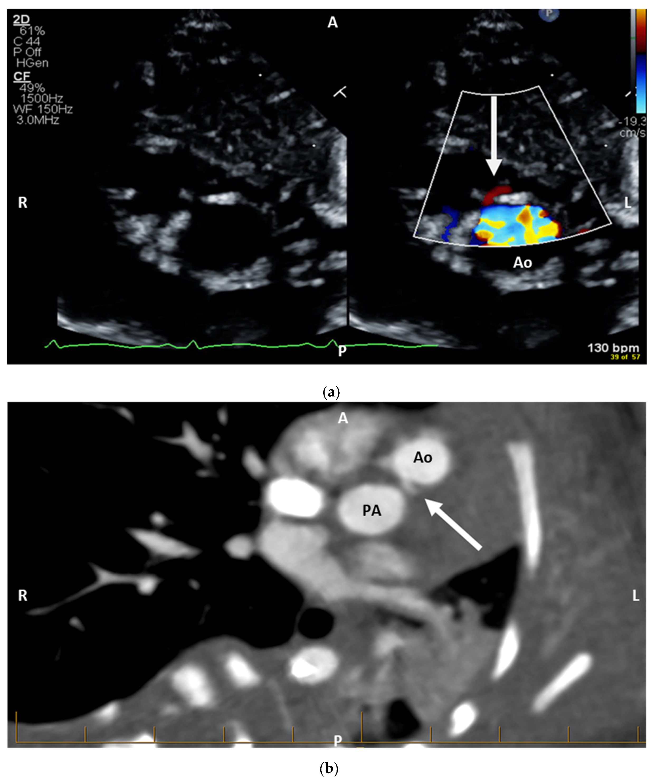 Hearts 05 00049 g002