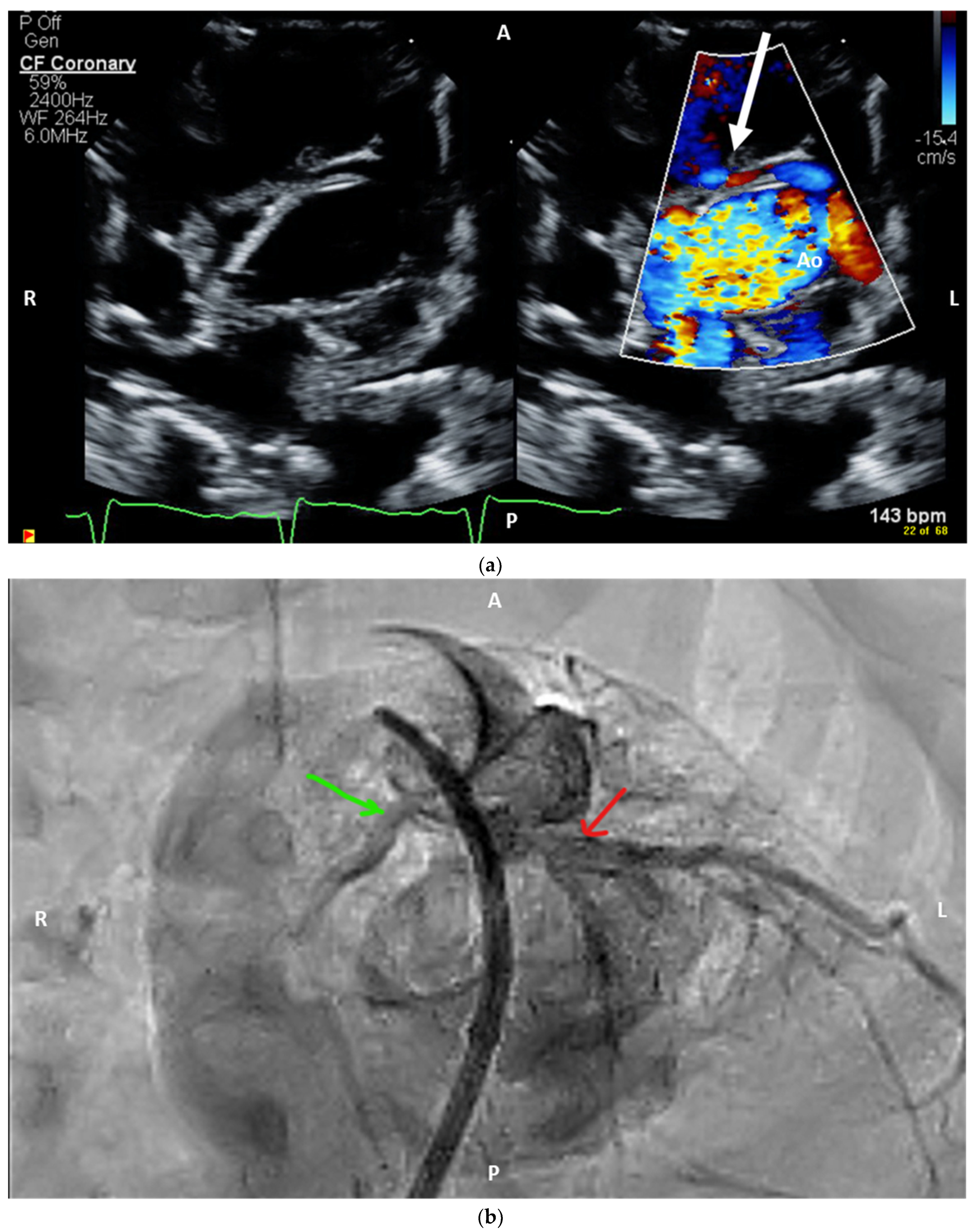 Hearts 05 00049 g003