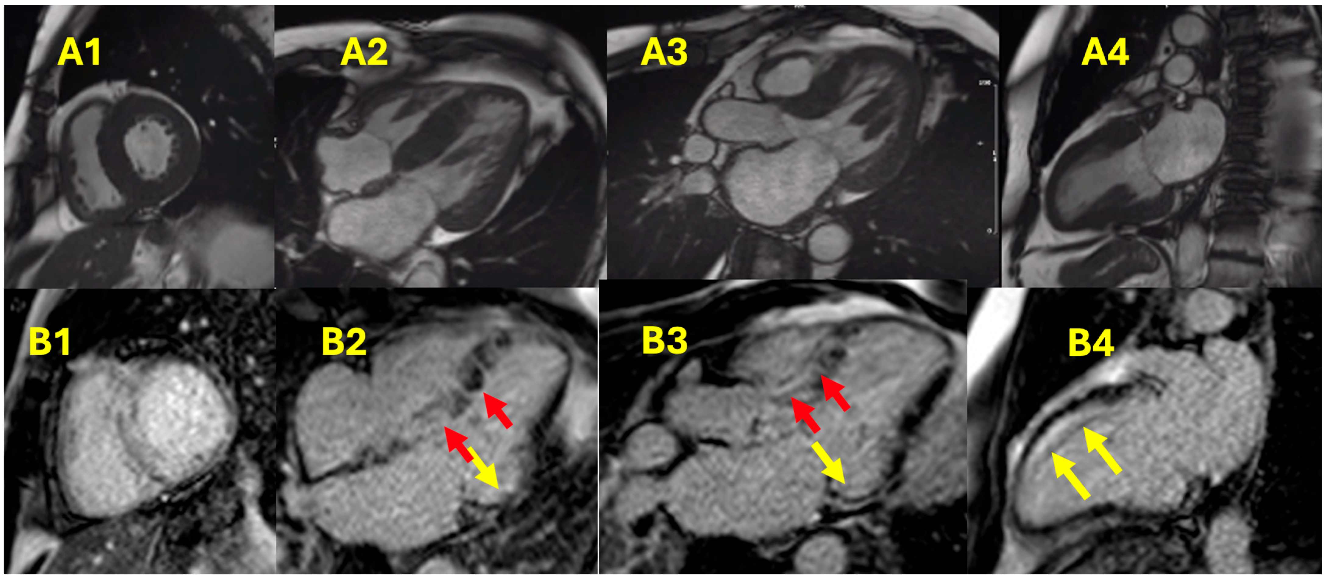 Hearts 06 00006 g003