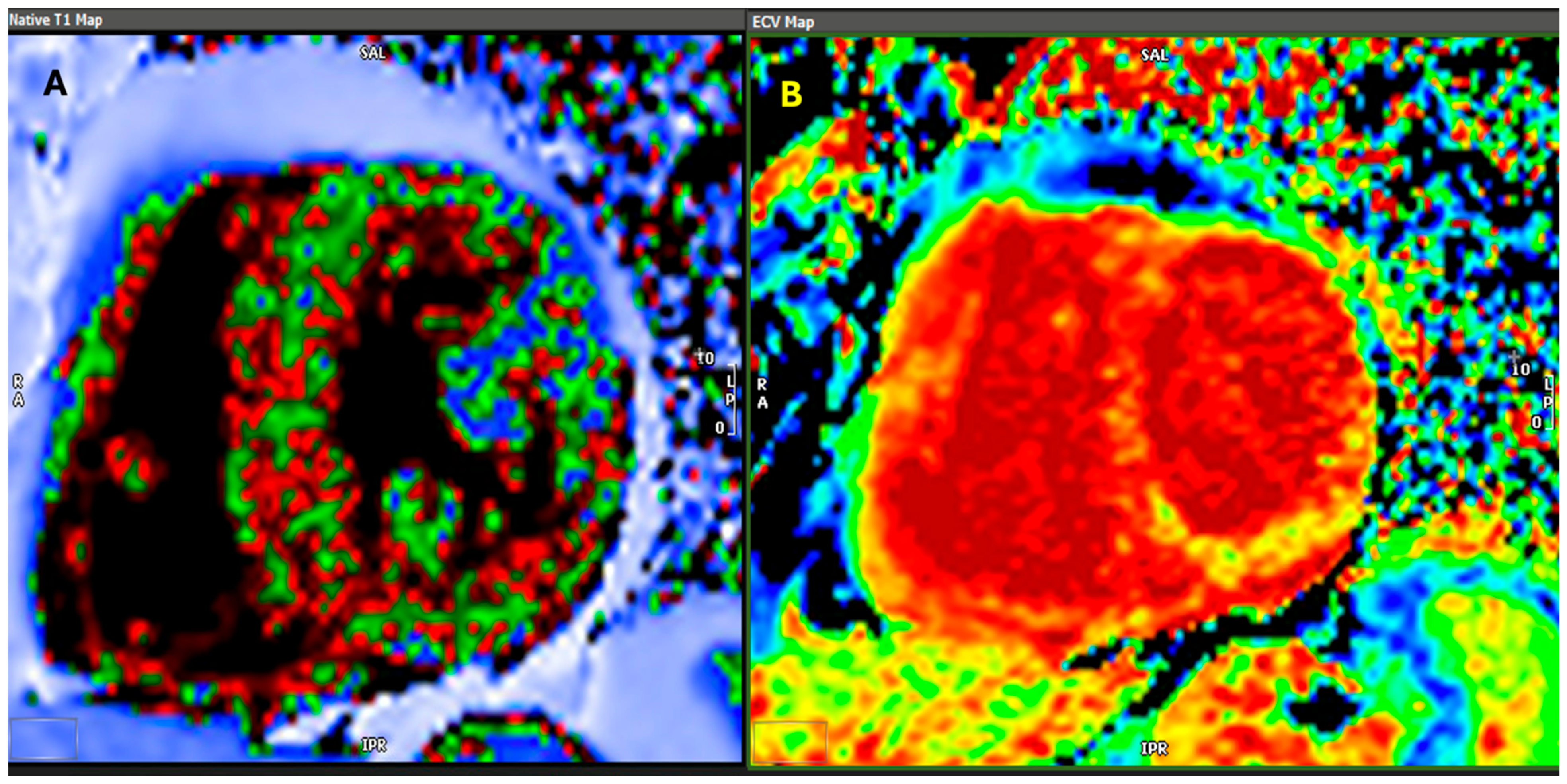 Hearts 06 00006 g004