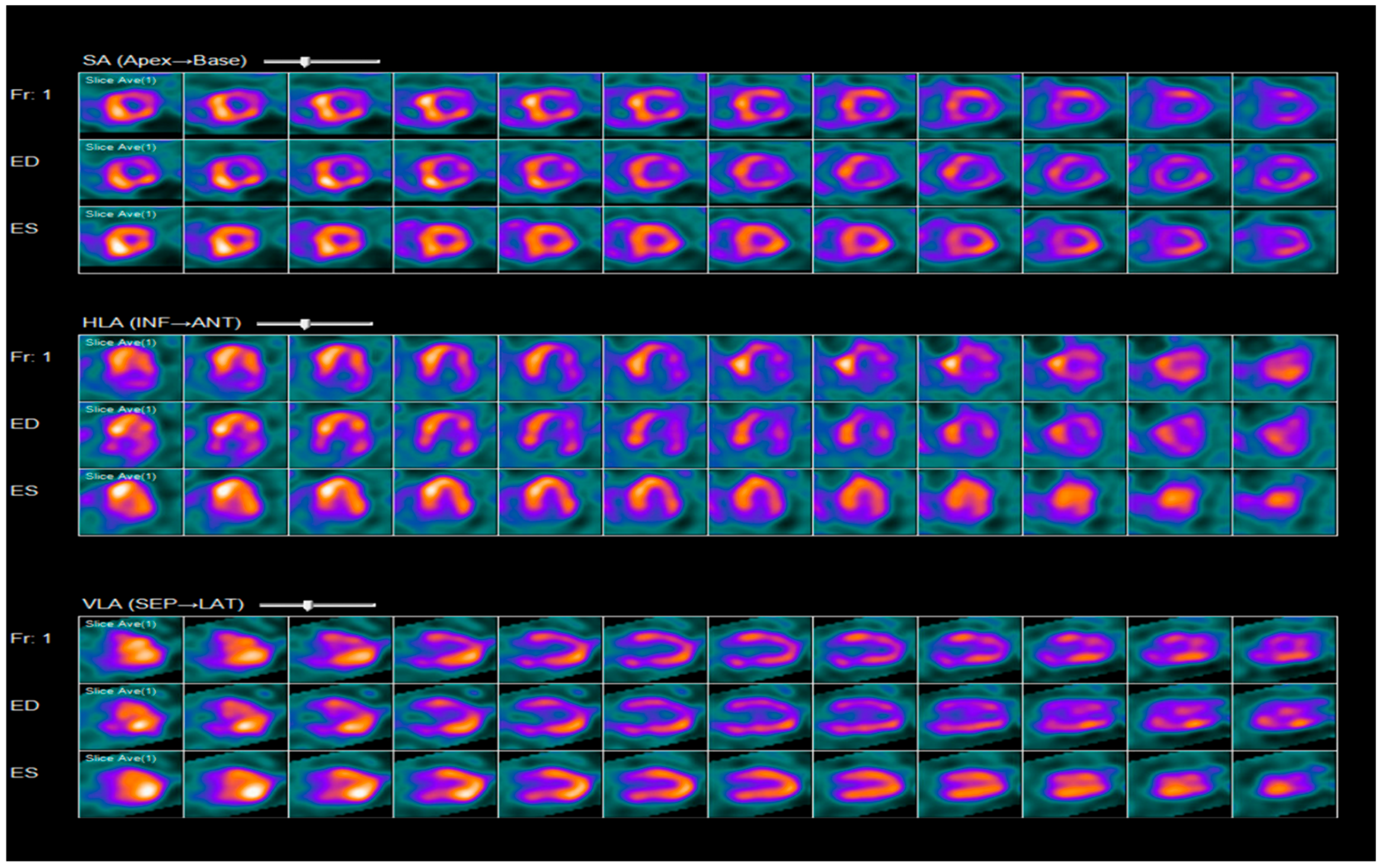 Hearts 06 00006 g005