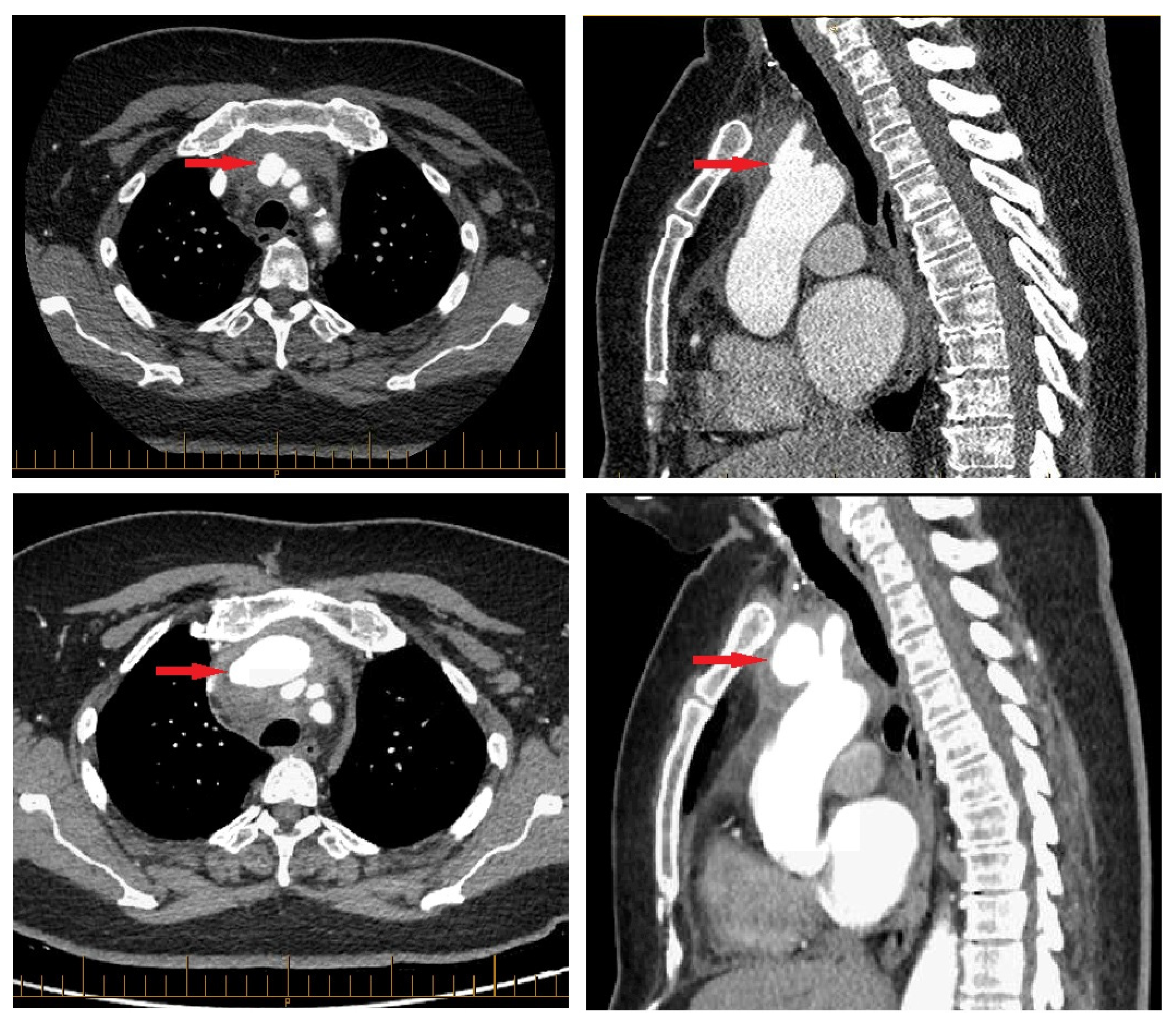 Hearts 06 00013 g001