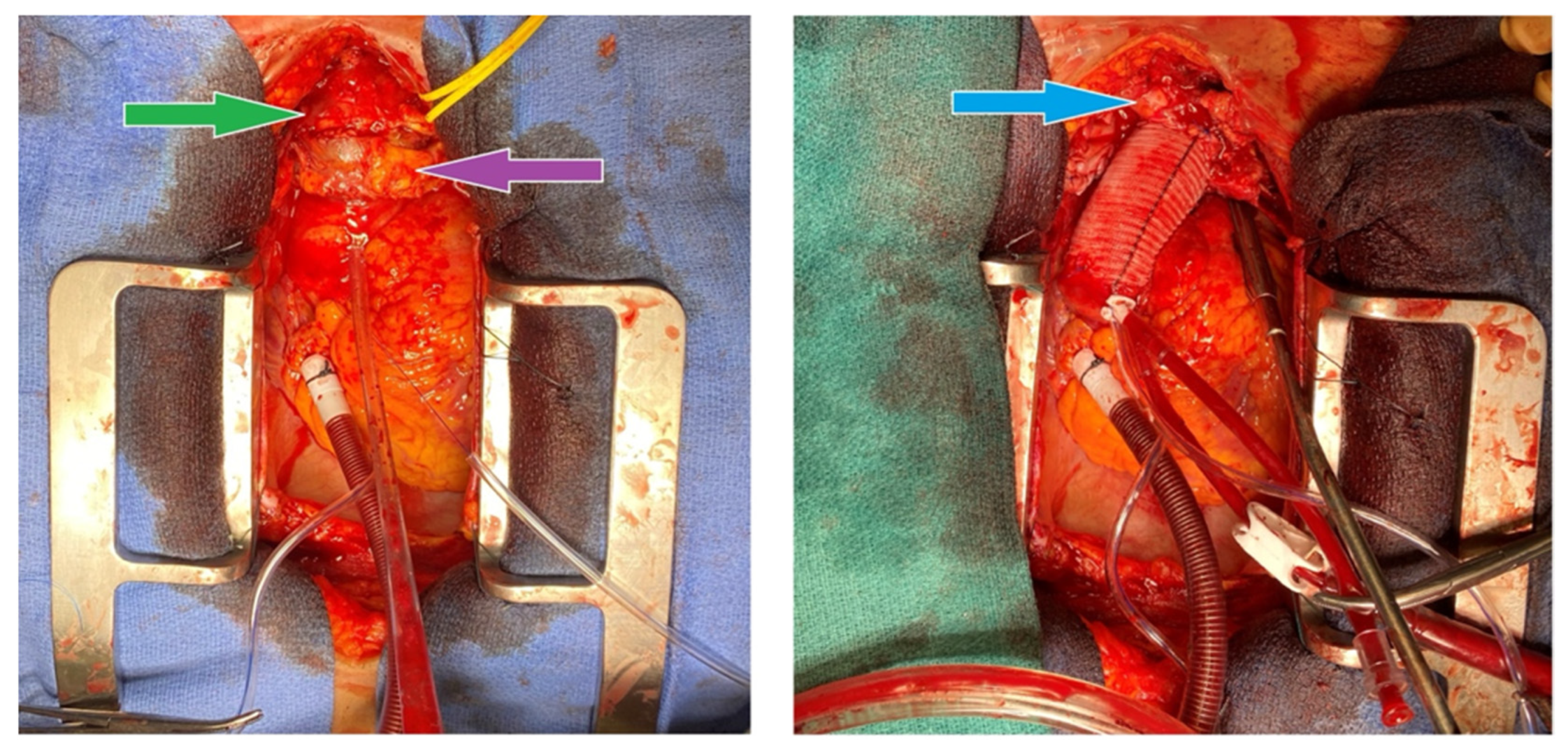 Hearts 06 00013 g003