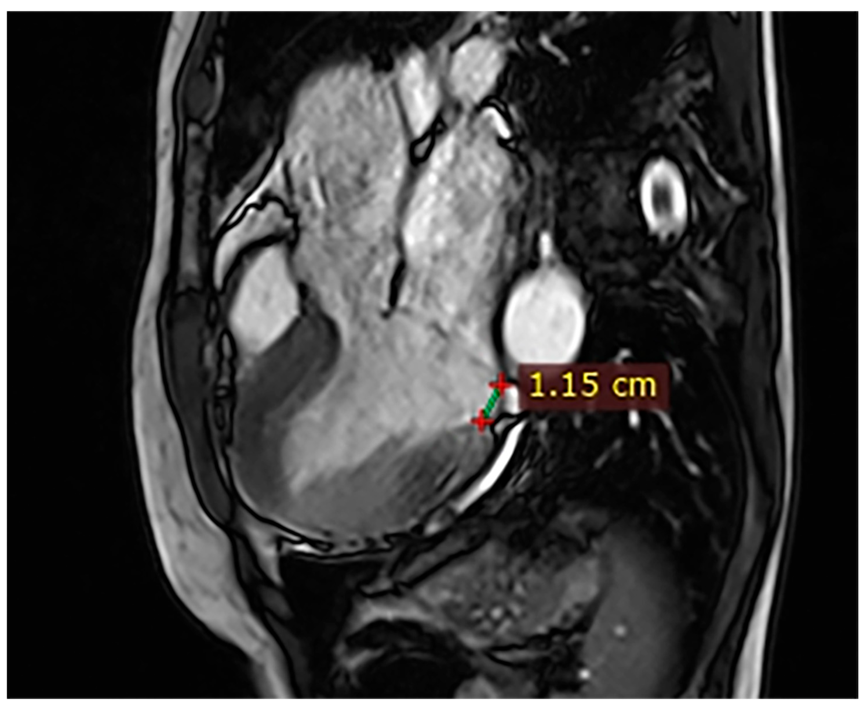 Hearts 07 00002 g002