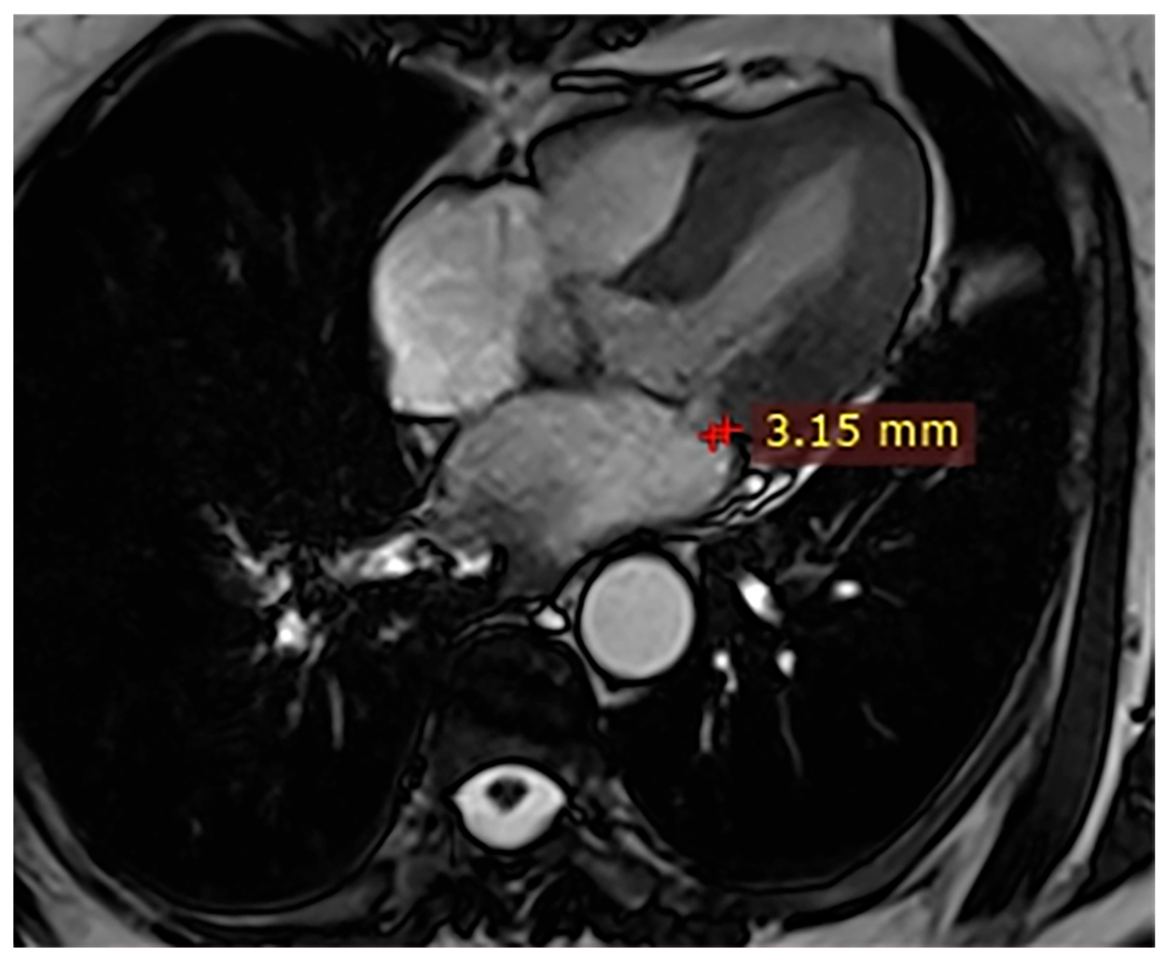 Hearts 07 00002 g003