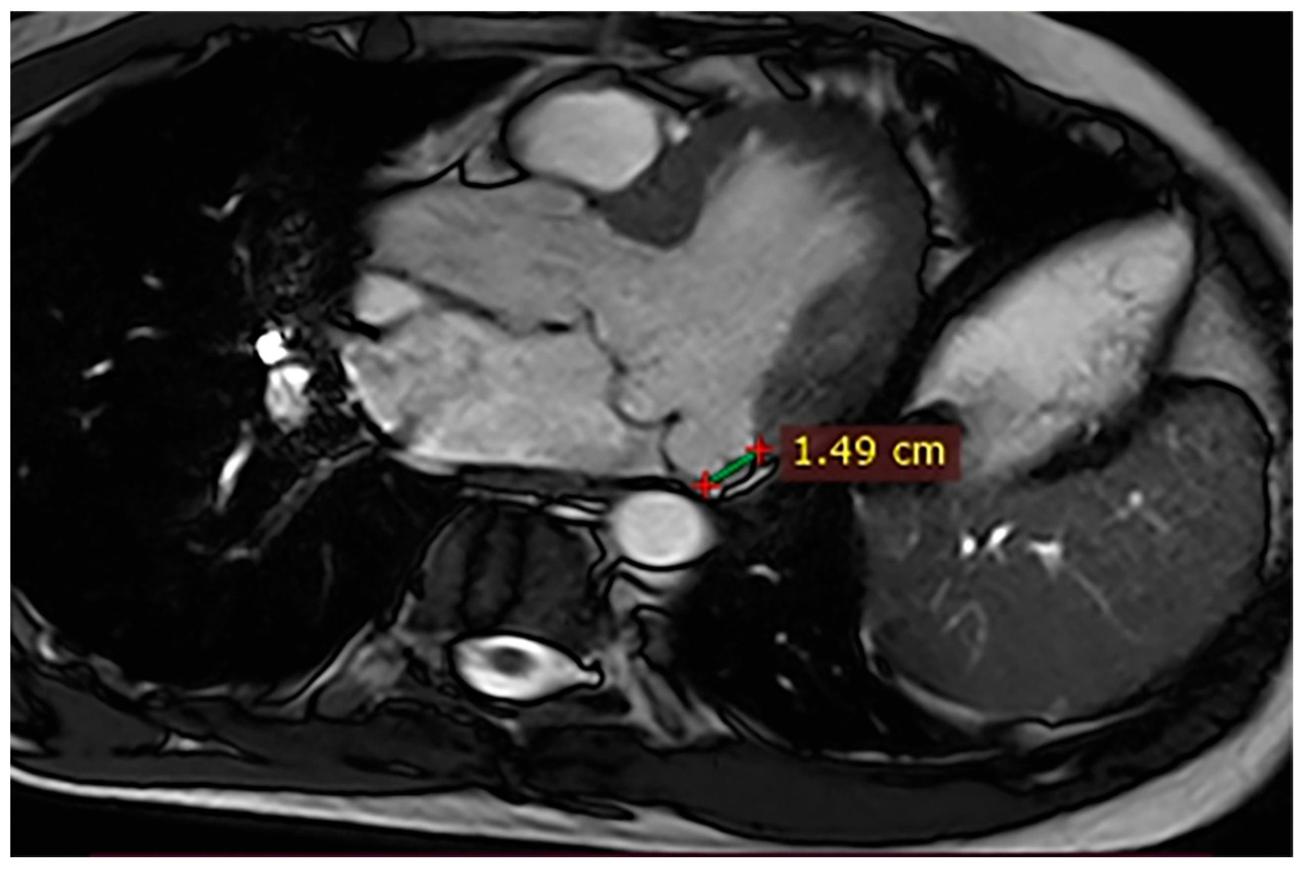 Hearts 07 00002 g004