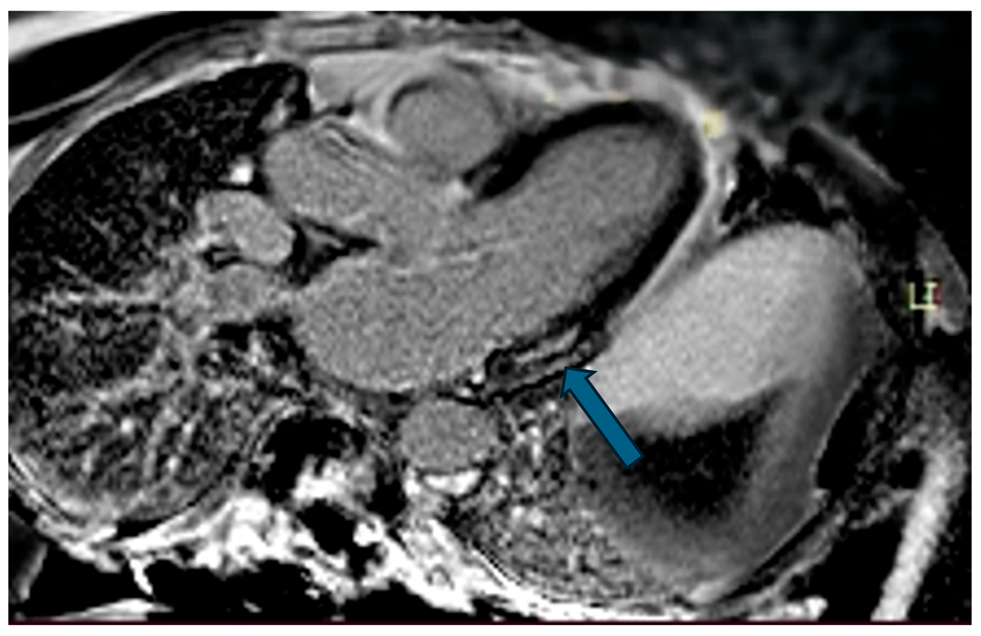 Hearts 07 00002 g005