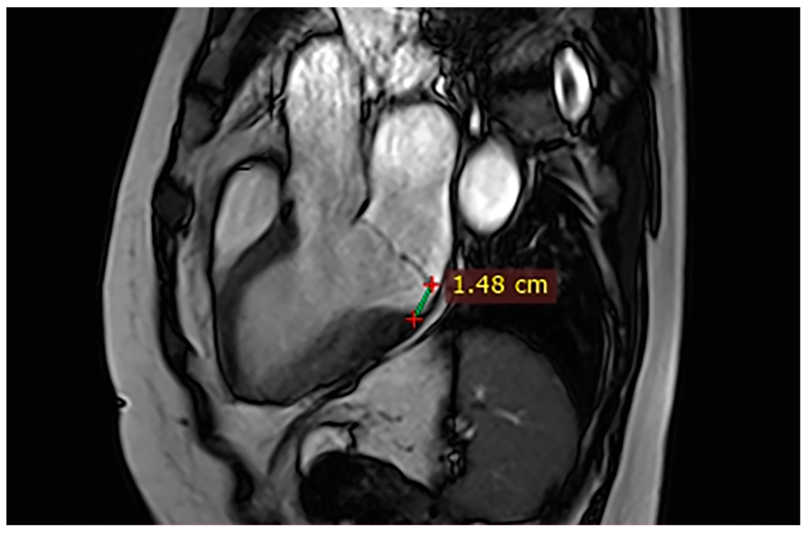 Hearts 07 00002 g006