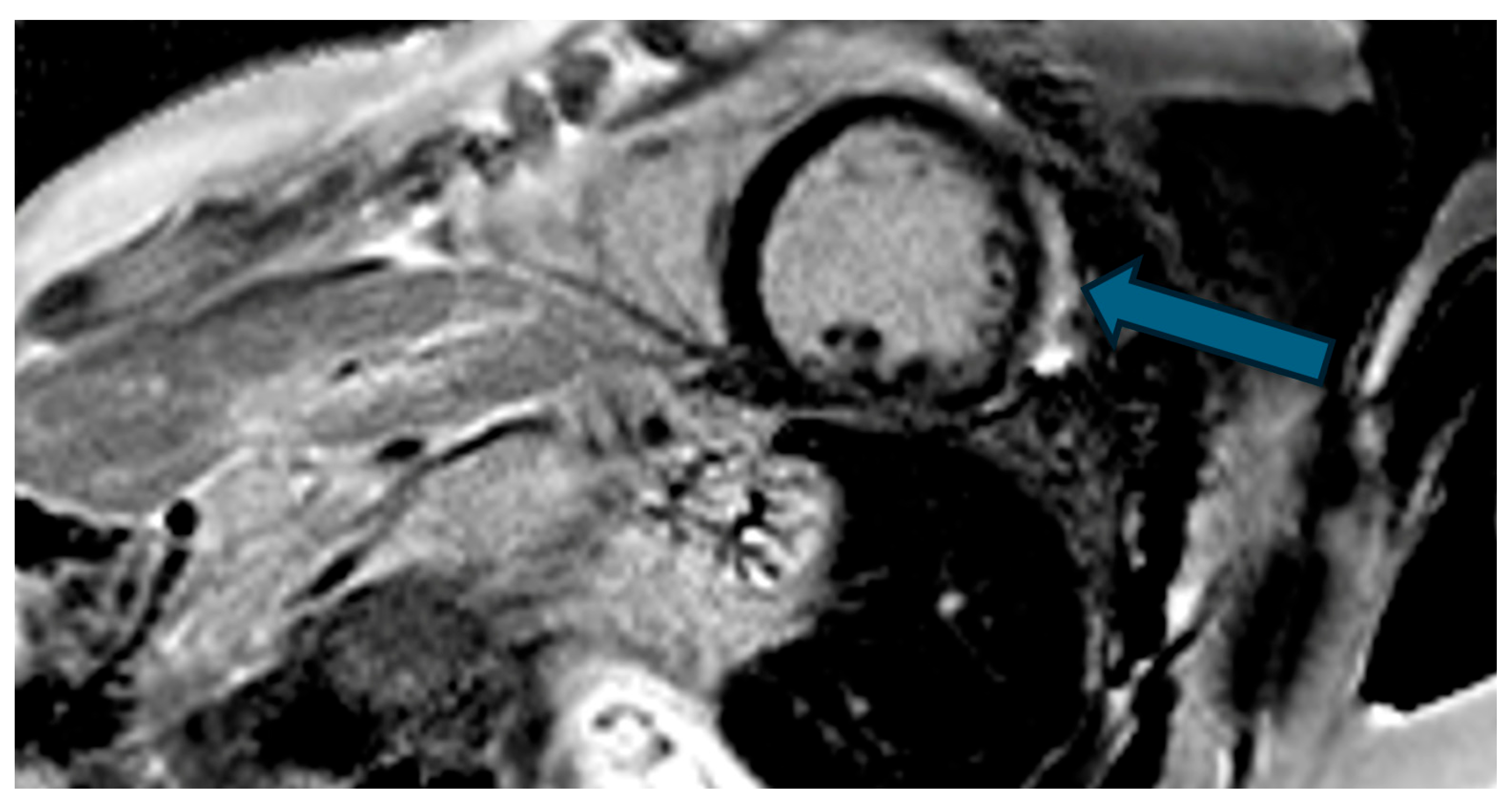 Hearts 07 00002 g007