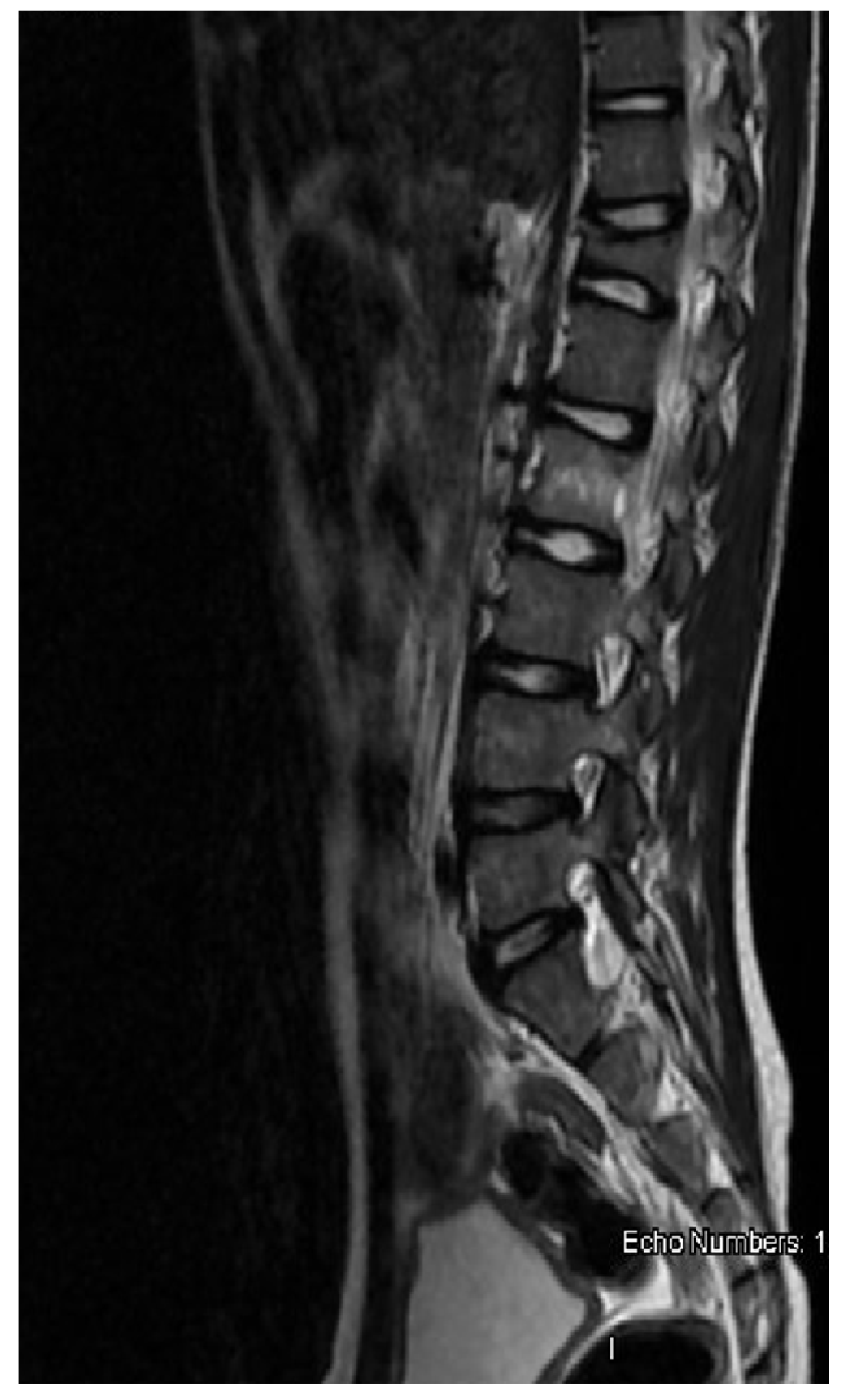 Hemato 02 00037 g002