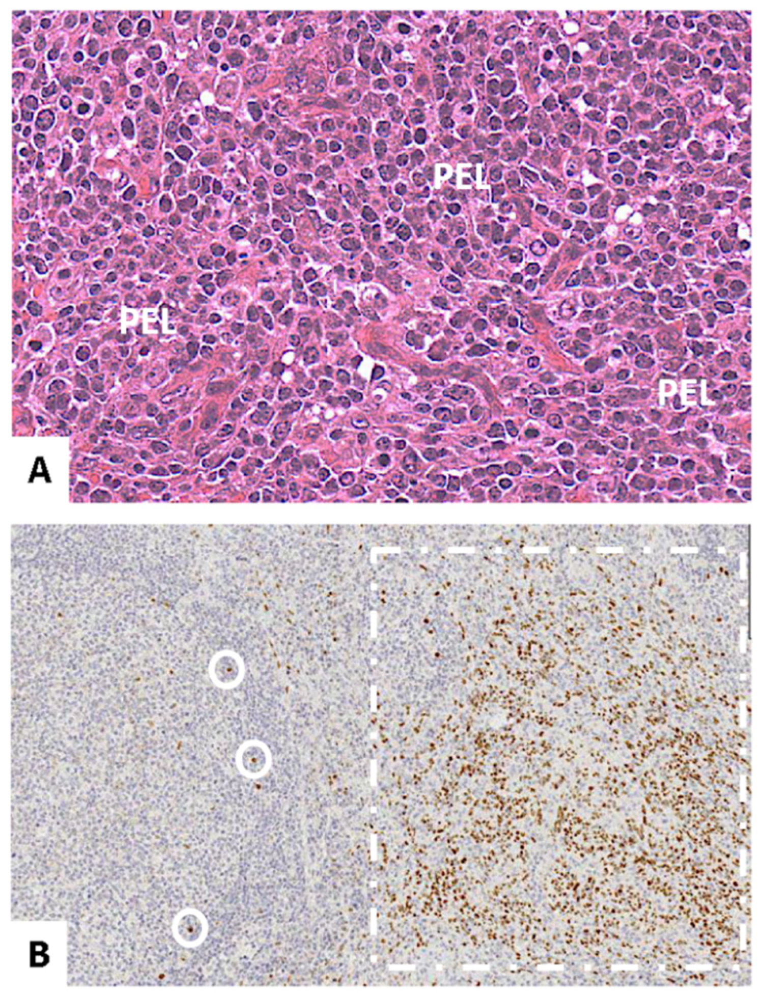 Hemato 02 00047 g002 550