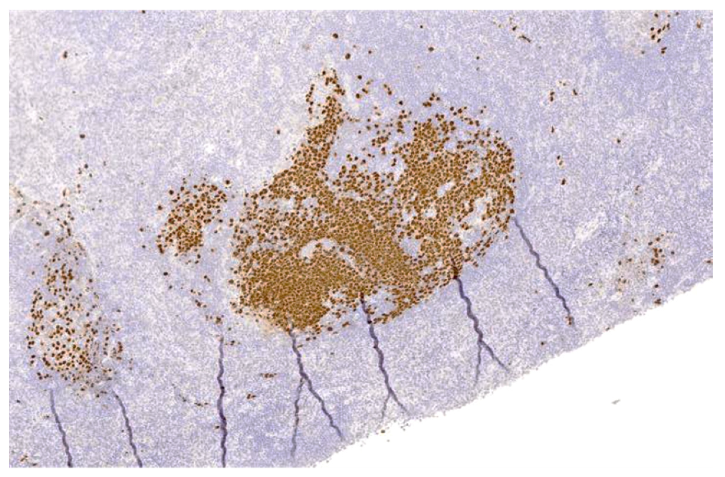 Hemato 02 00047 g004 550