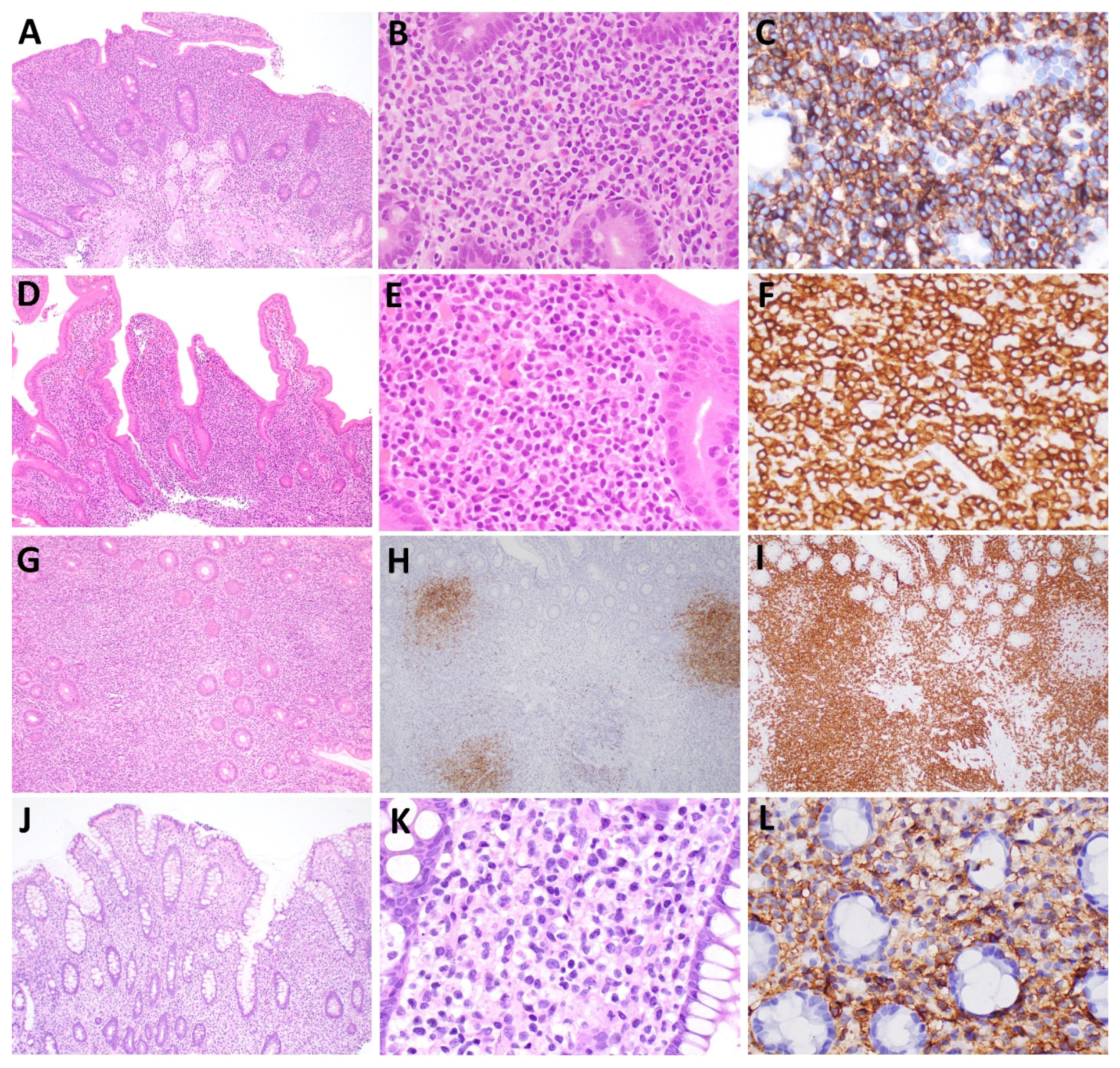 Hemato 03 00018 g001 Hemato 03 00018 g001