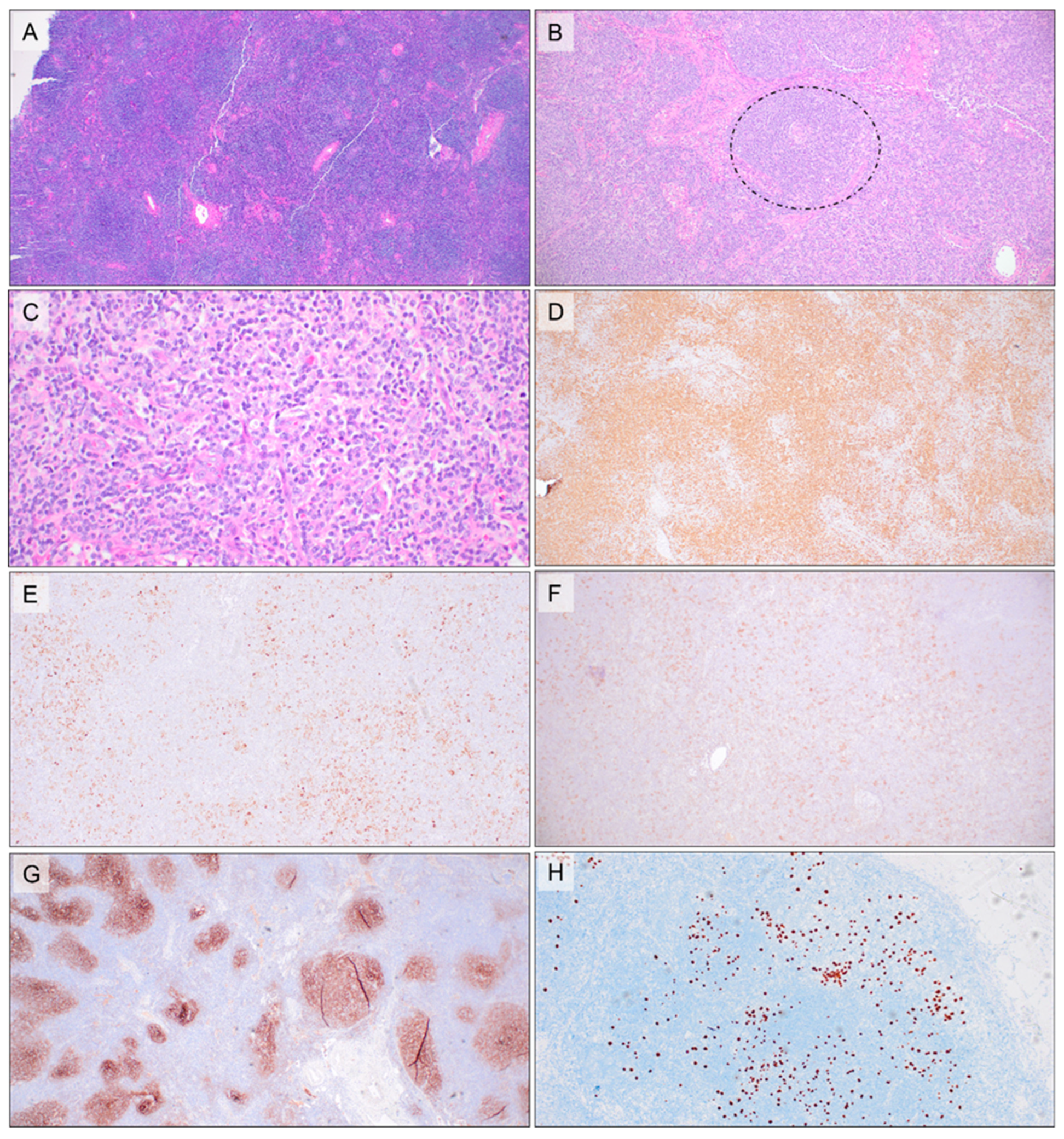 Hemato 03 00020 g002