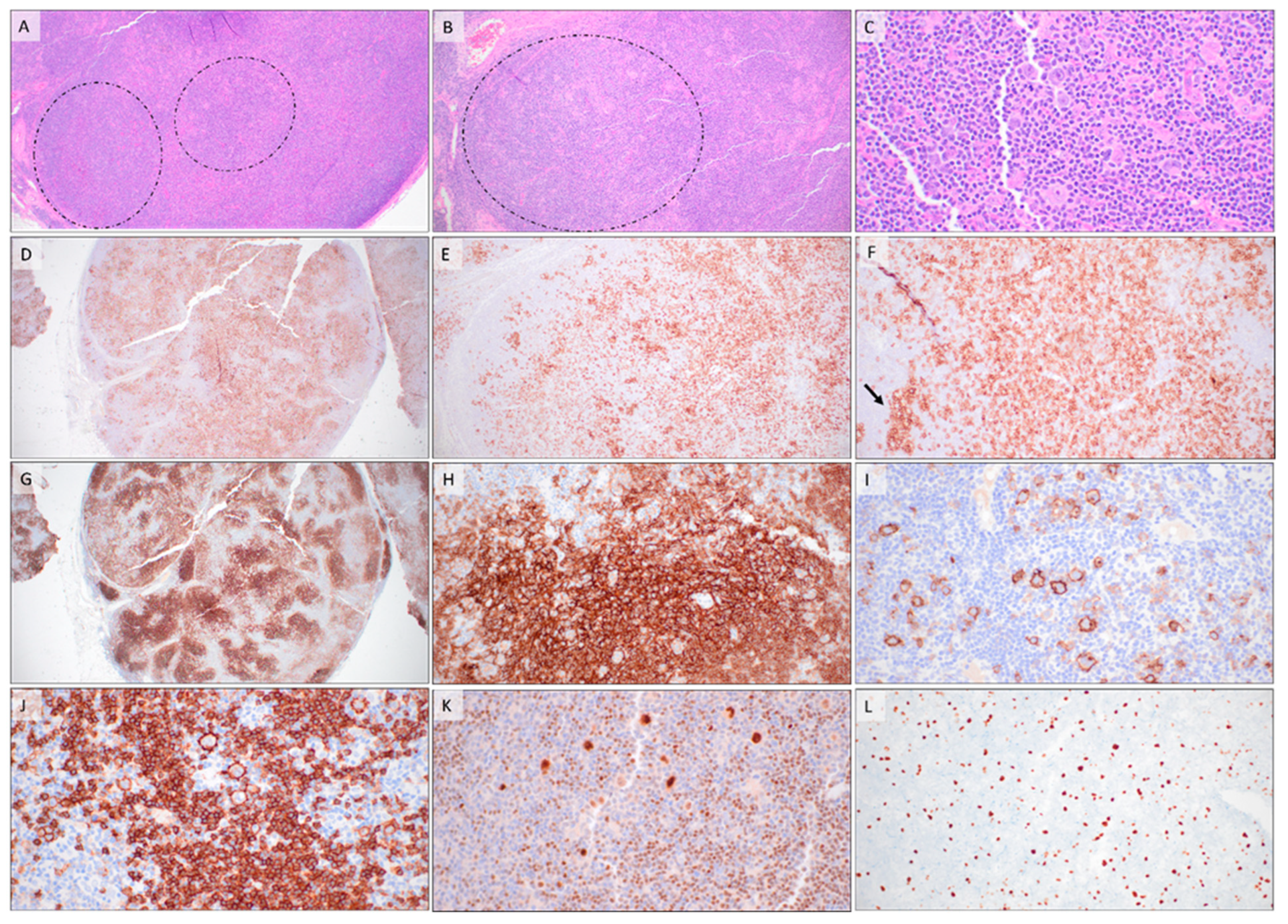 Hemato 03 00020 g004