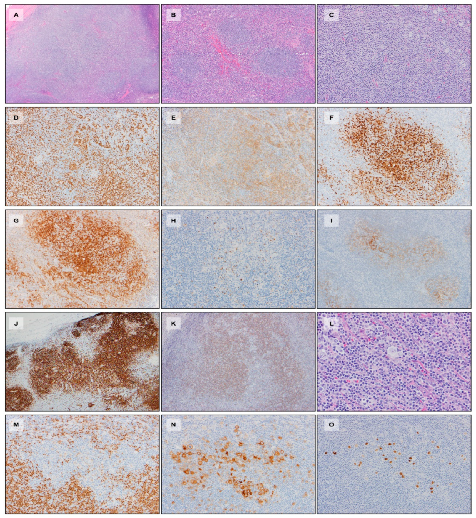 Hemato 03 00020 g006