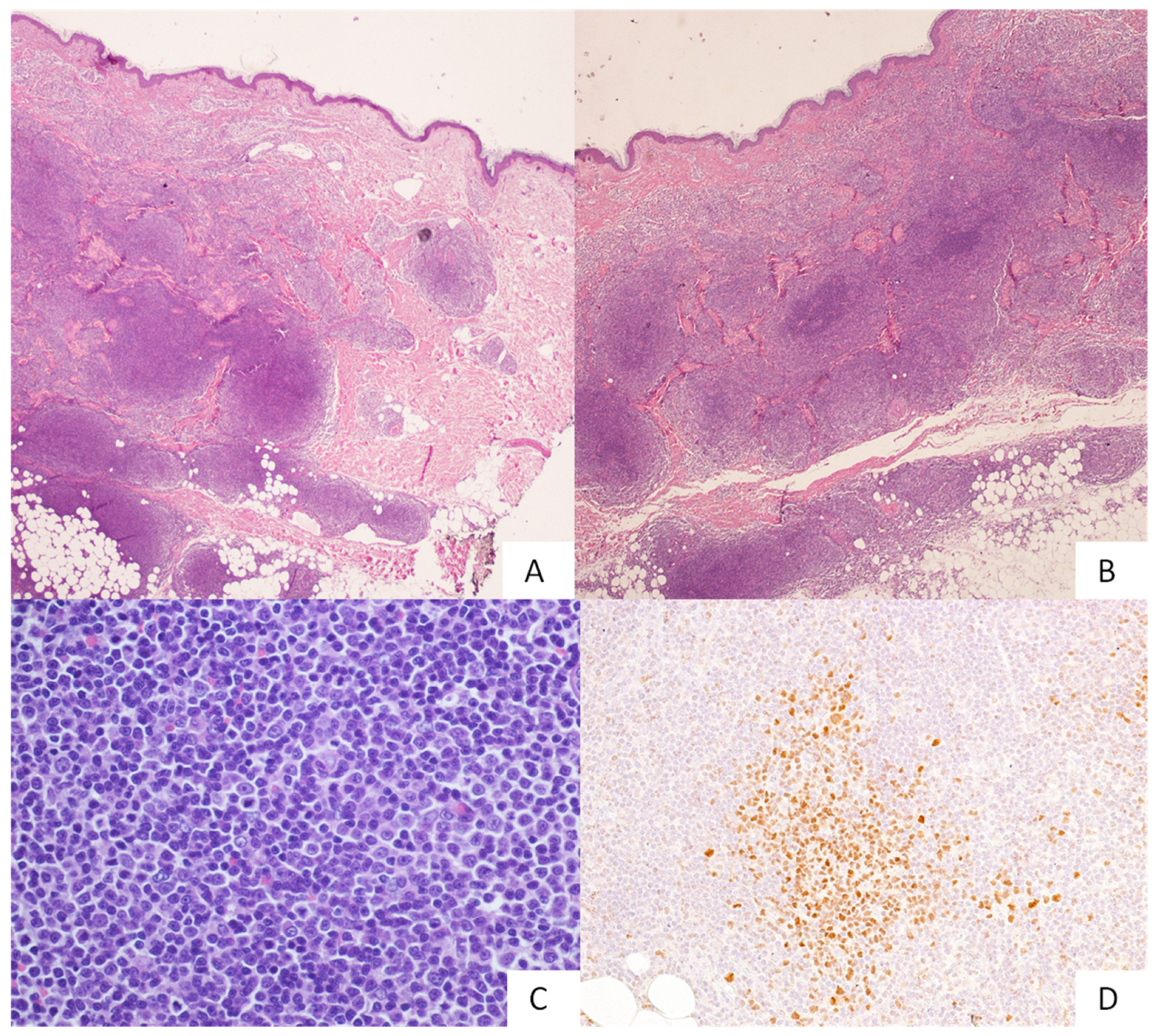 Hemato 03 00023 g002