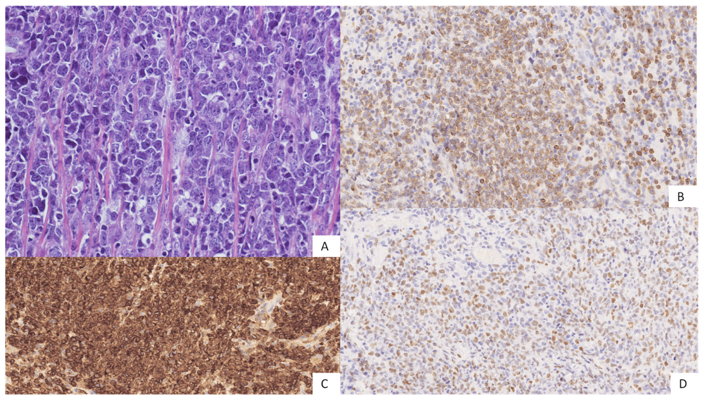 Hemato 03 00023 g003