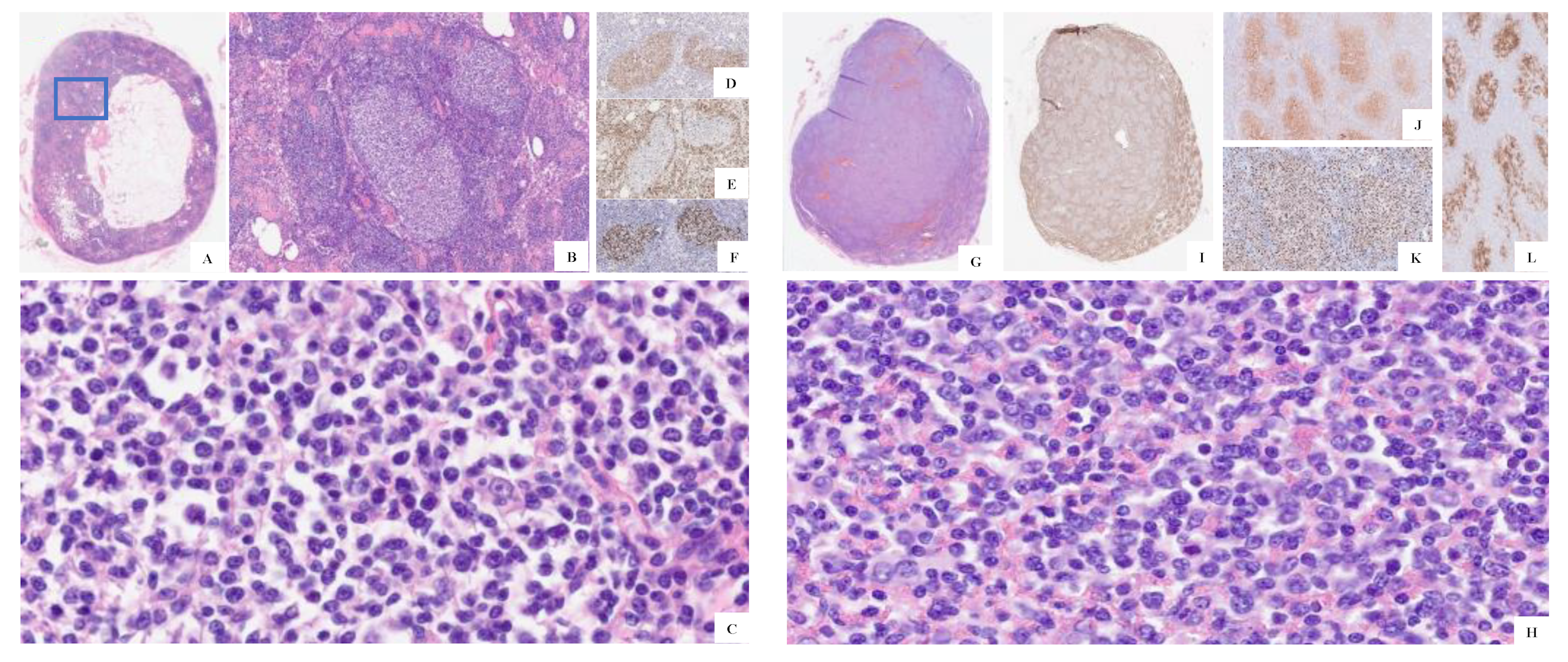 Hemato 03 00043 g003 Hemato 03 00043 g003