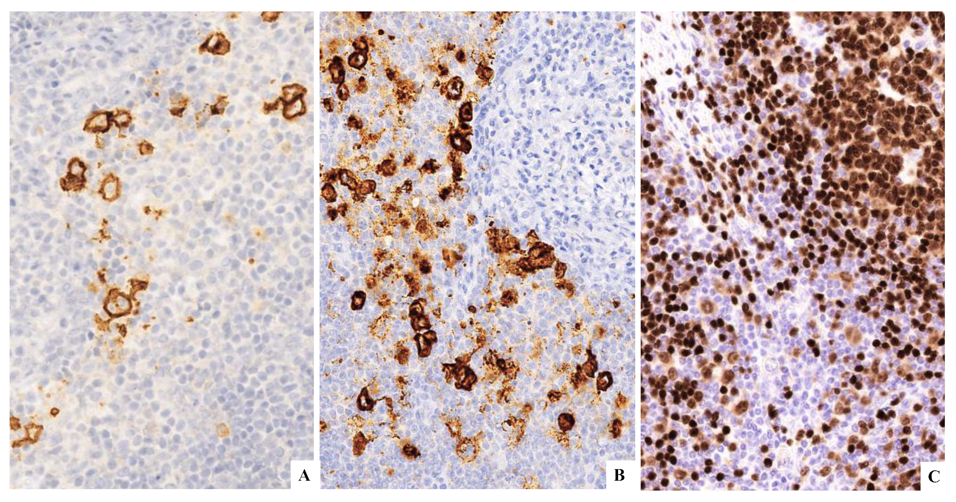 Hemato 03 00043 g005 Hemato 03 00043 g005
