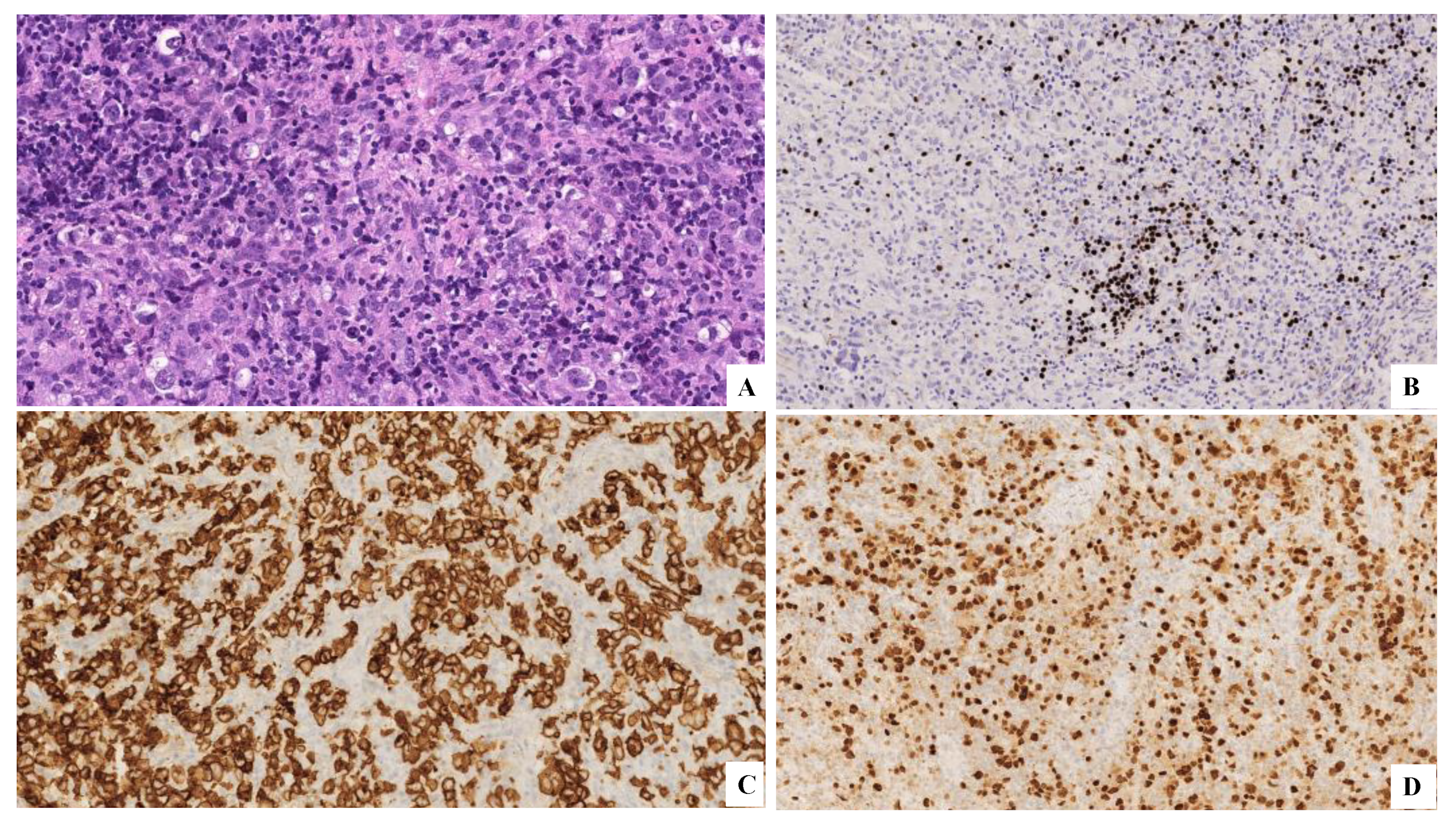 Hemato 03 00043 g006 Hemato 03 00043 g006