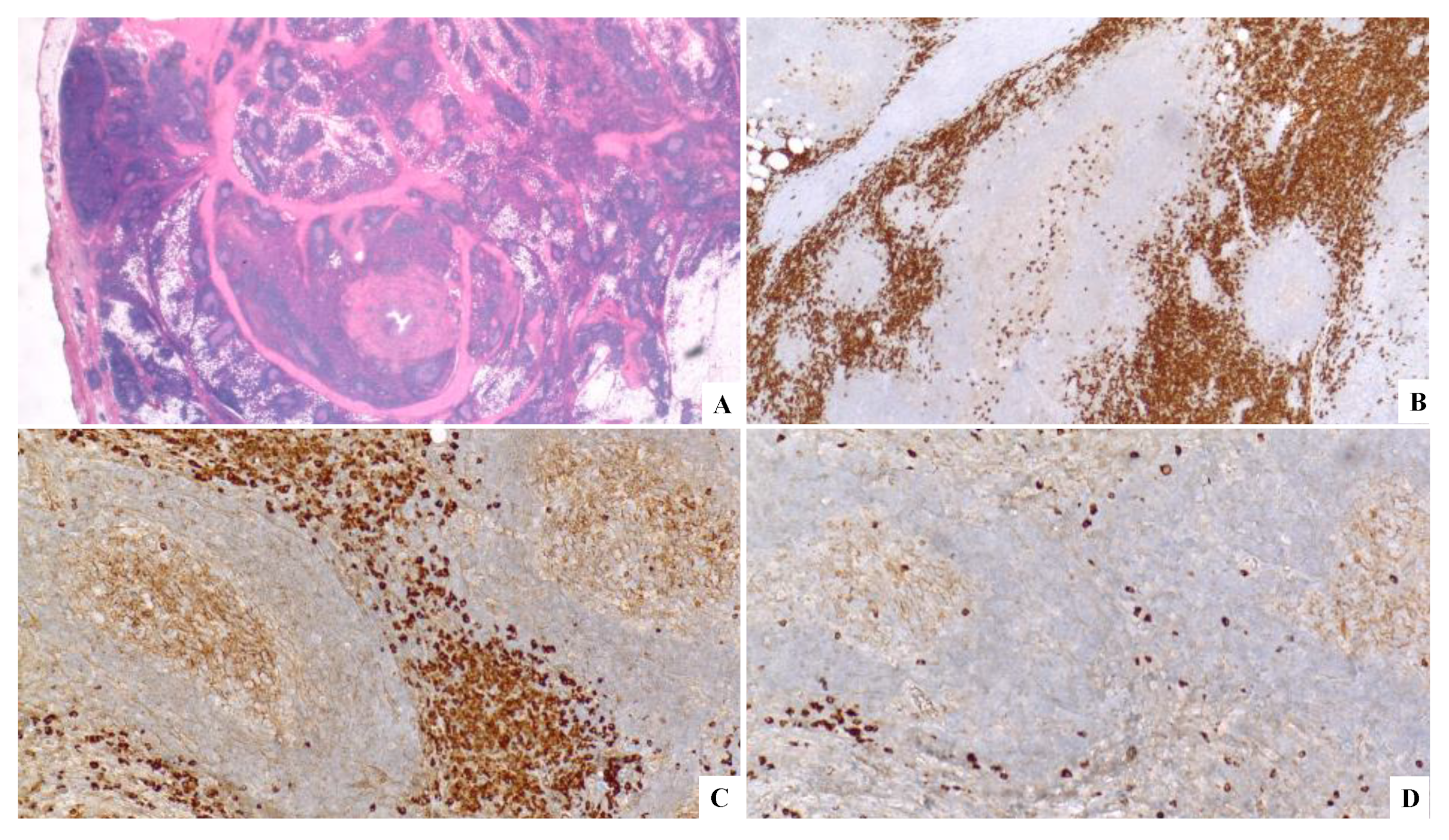 Hemato 03 00043 g008 Hemato 03 00043 g008