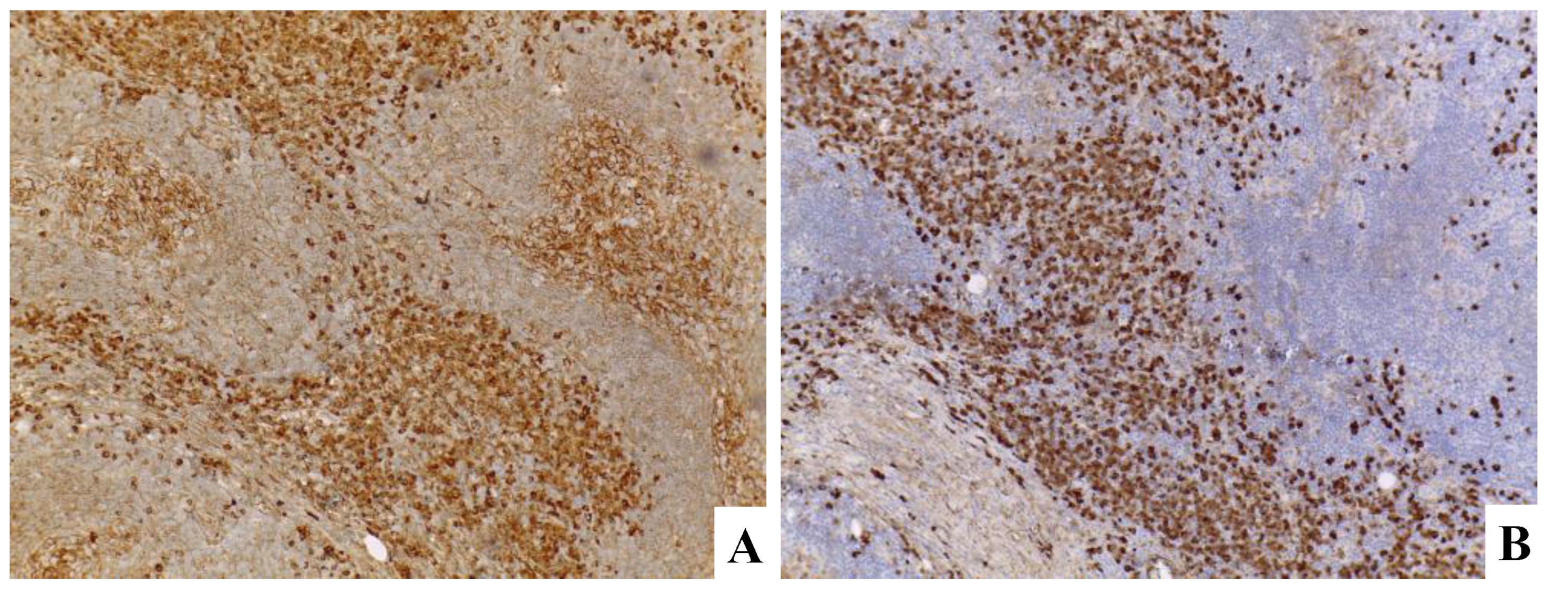 Hemato 03 00043 g009 Hemato 03 00043 g009