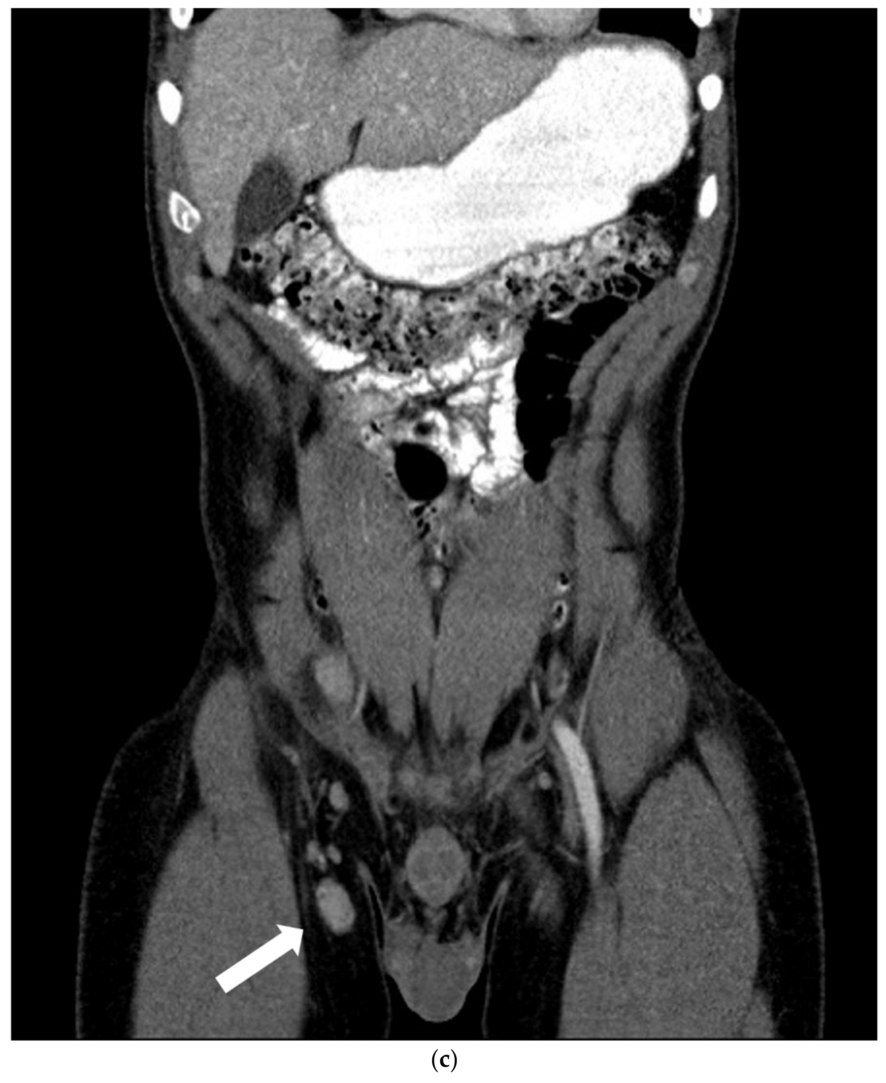 Hemato 03 00052 g002b