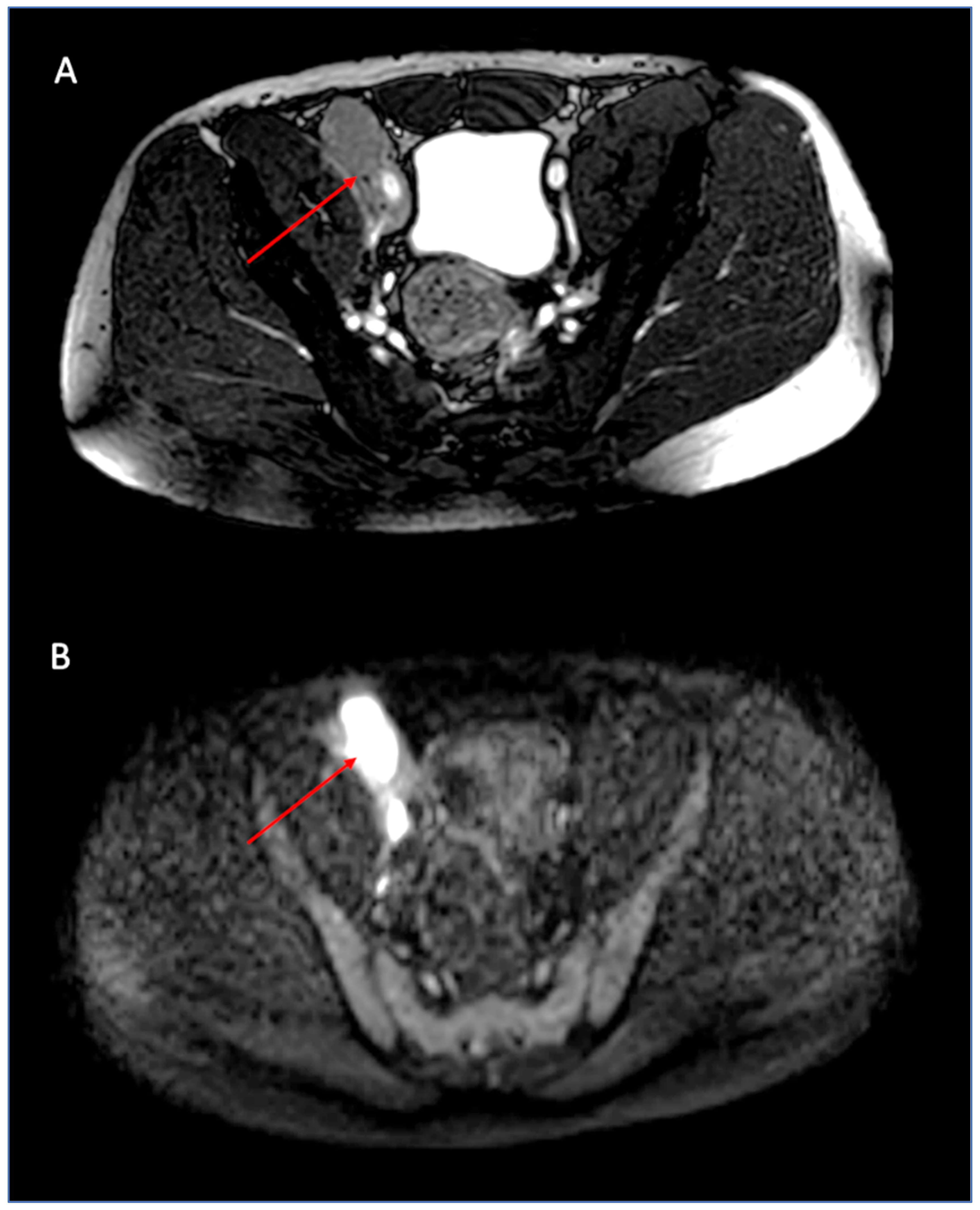 Hemato 03 00052 g003