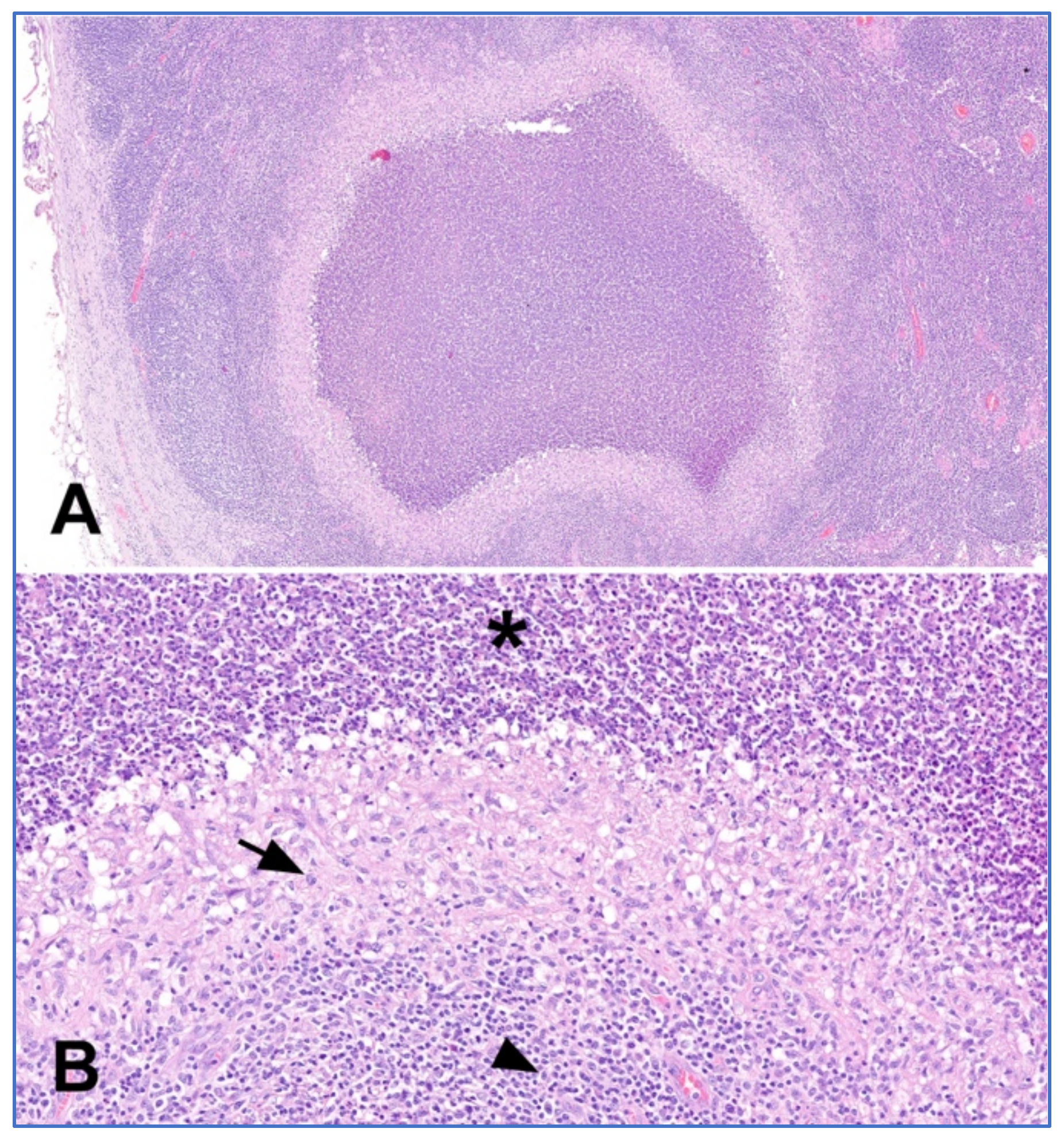 Hemato 03 00052 g005