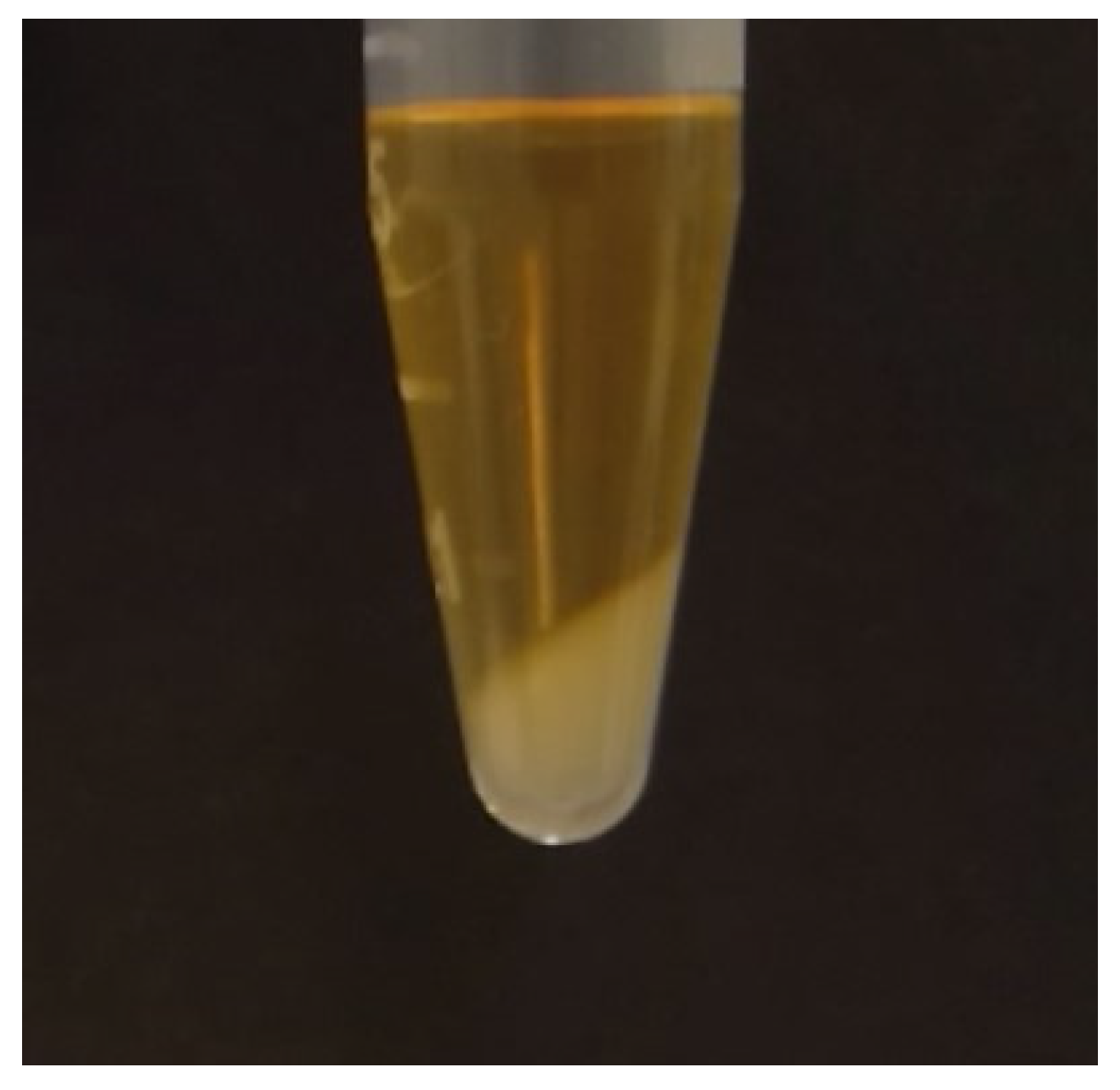 Hemato 04 00019 g003 Hemato 04 00019 g003