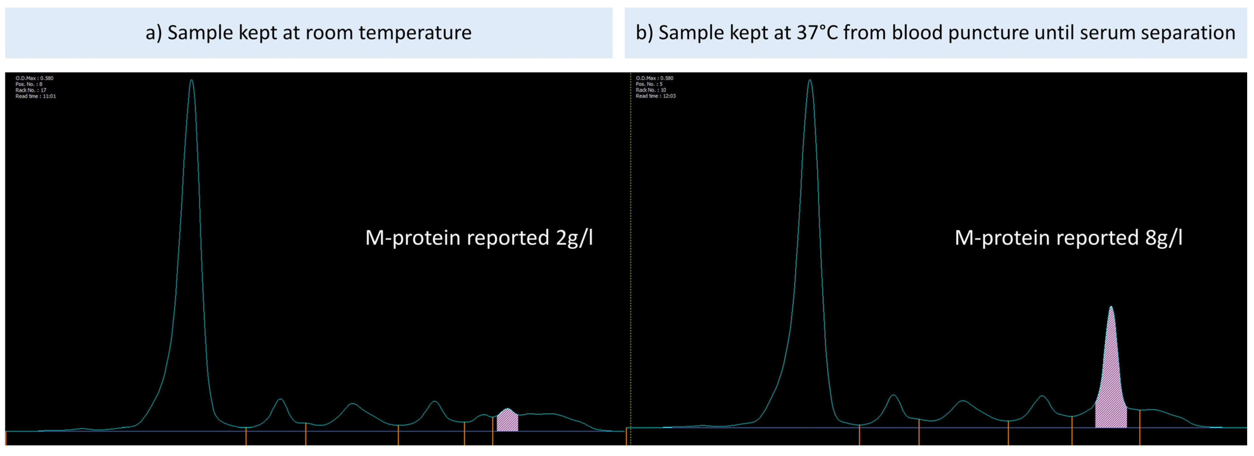 Hemato 04 00019 g004 Hemato 04 00019 g004