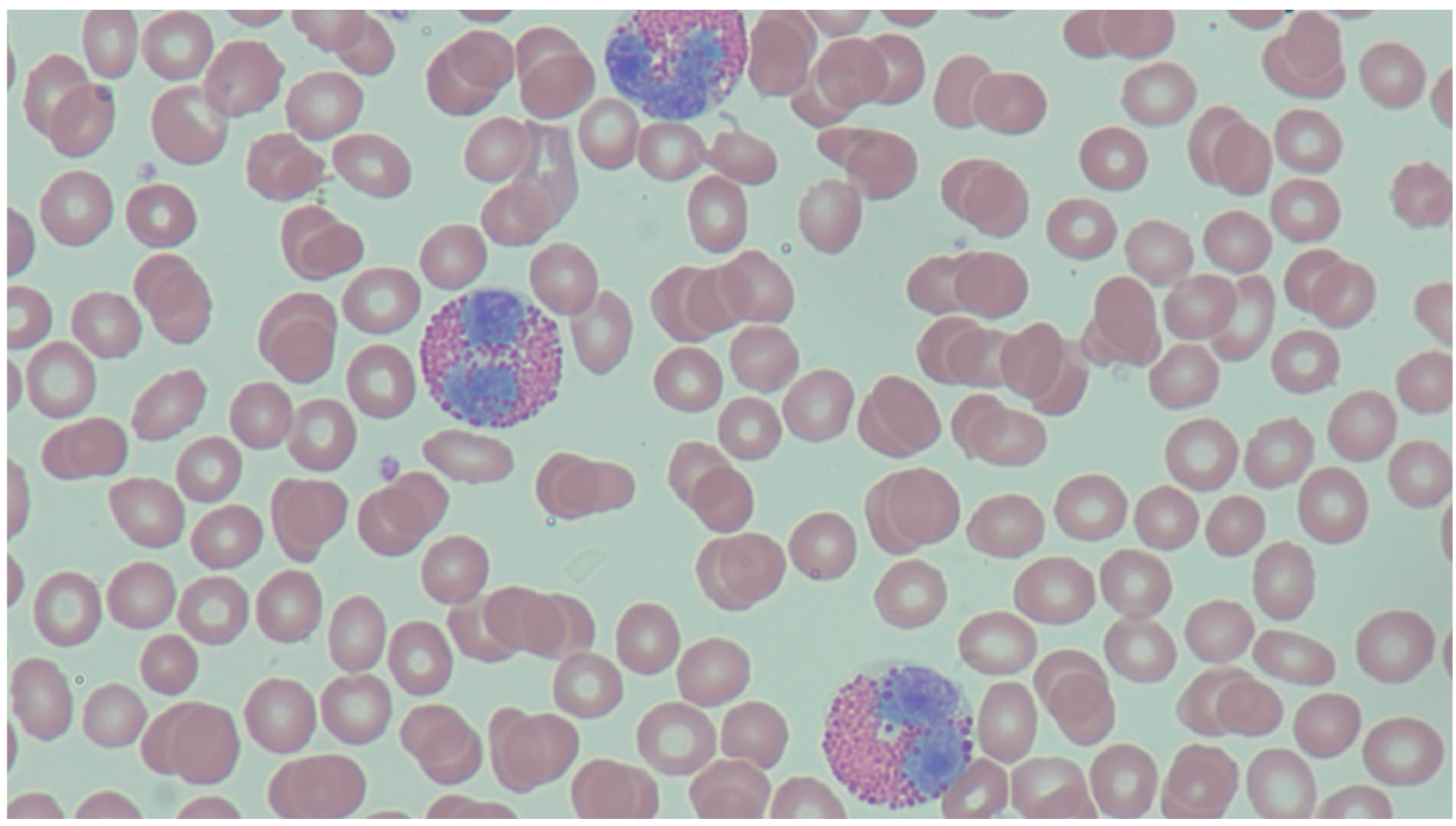 Hemato 05 00008 g001 Hemato 05 00008 g001