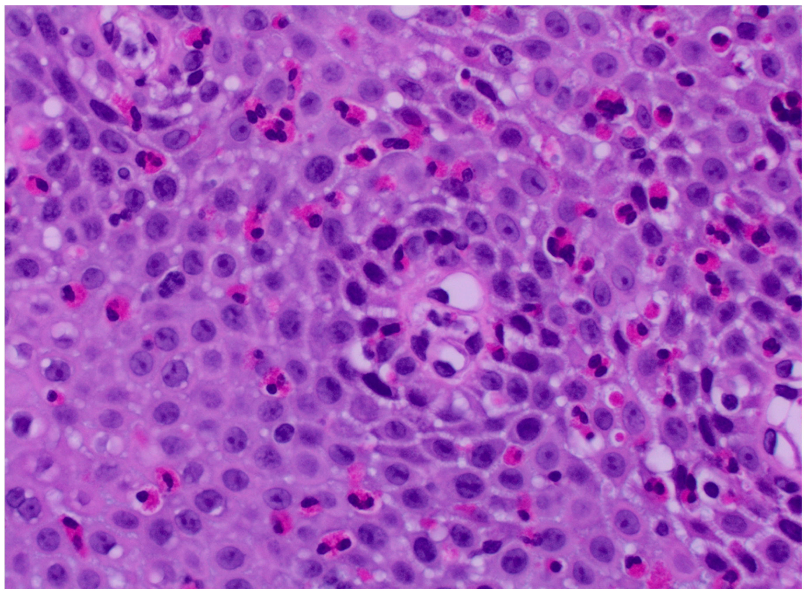 Hemato 05 00008 g002 Hemato 05 00008 g002