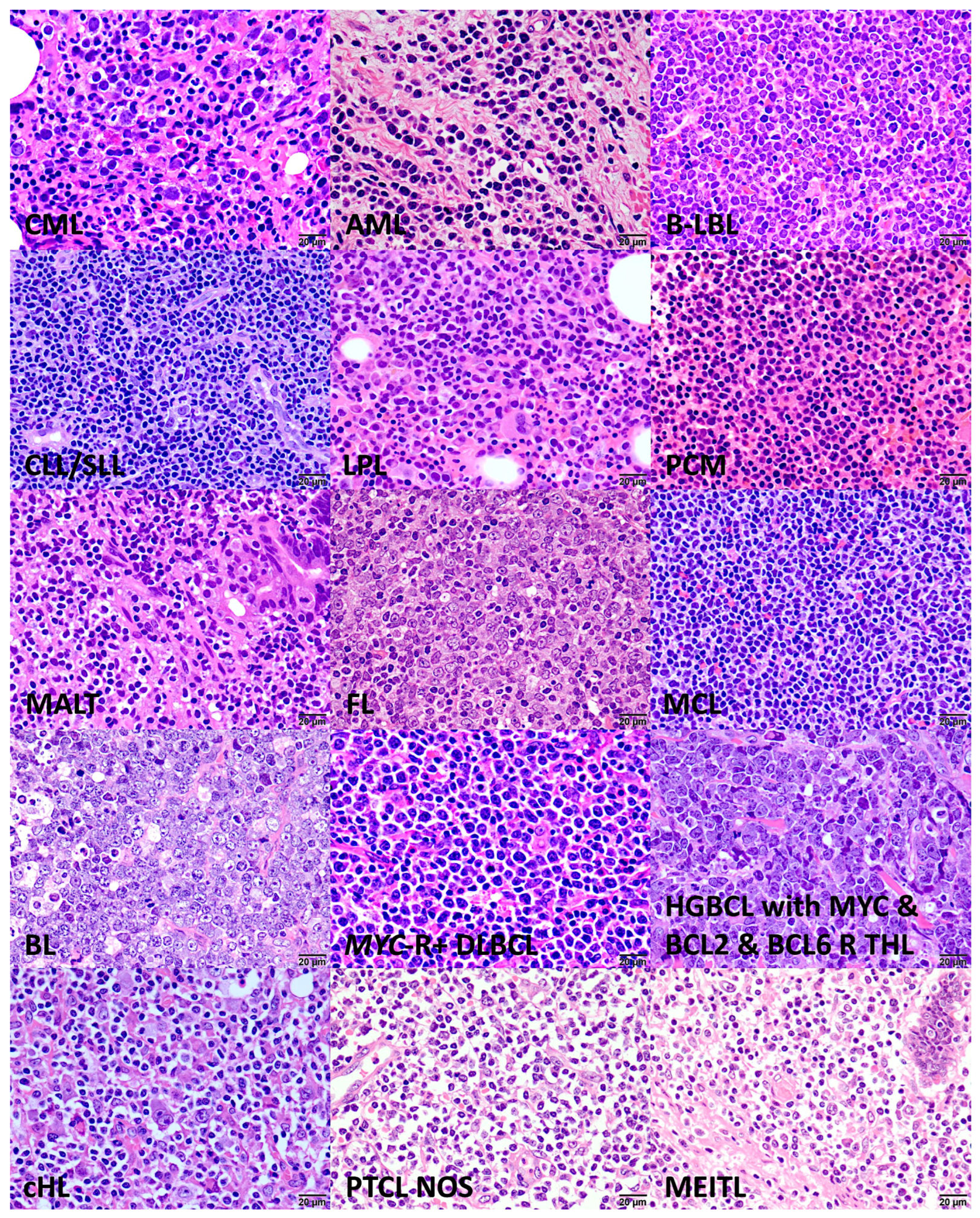 Hemato 05 00011 g002