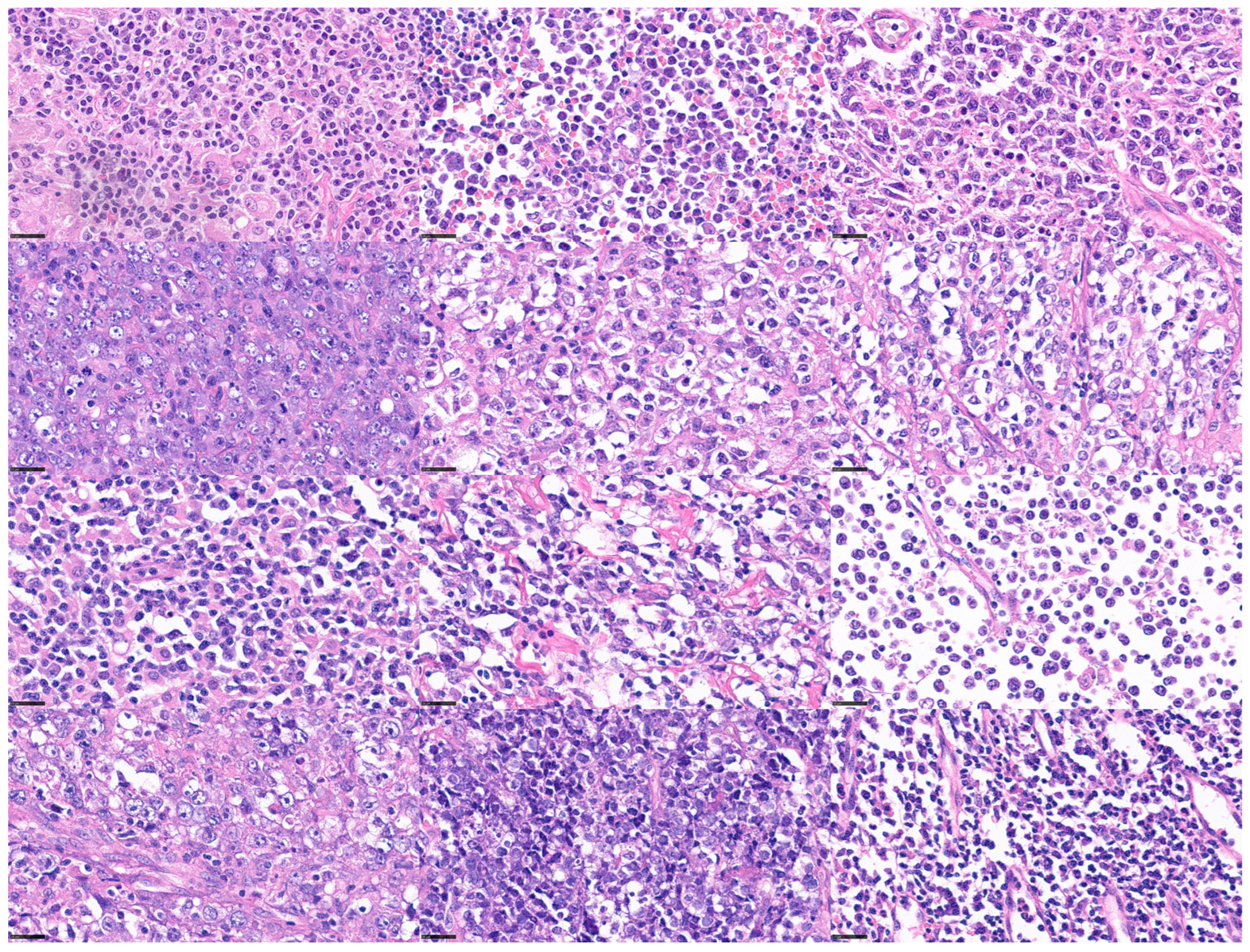 Hemato 05 00011 g003