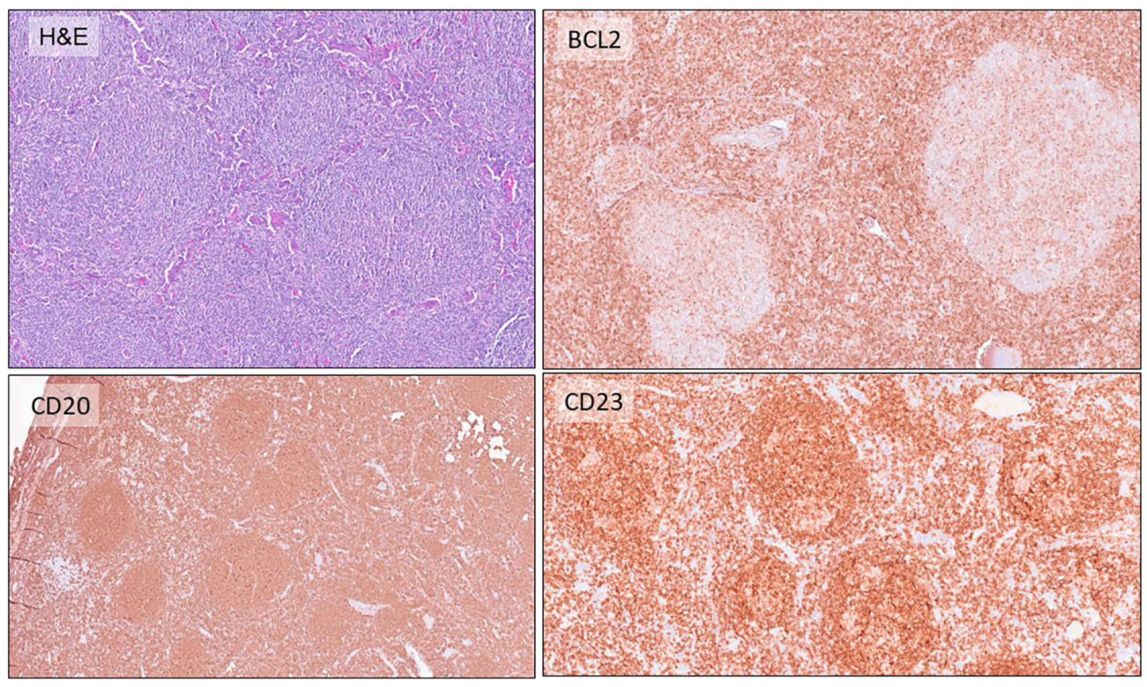 Hemato 05 00013 g002